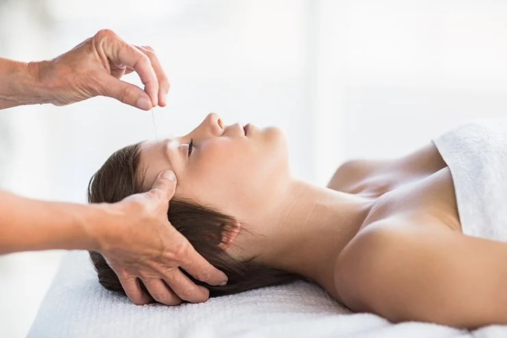 Everything You Need to Know About Using Acupuncture for Fertility
