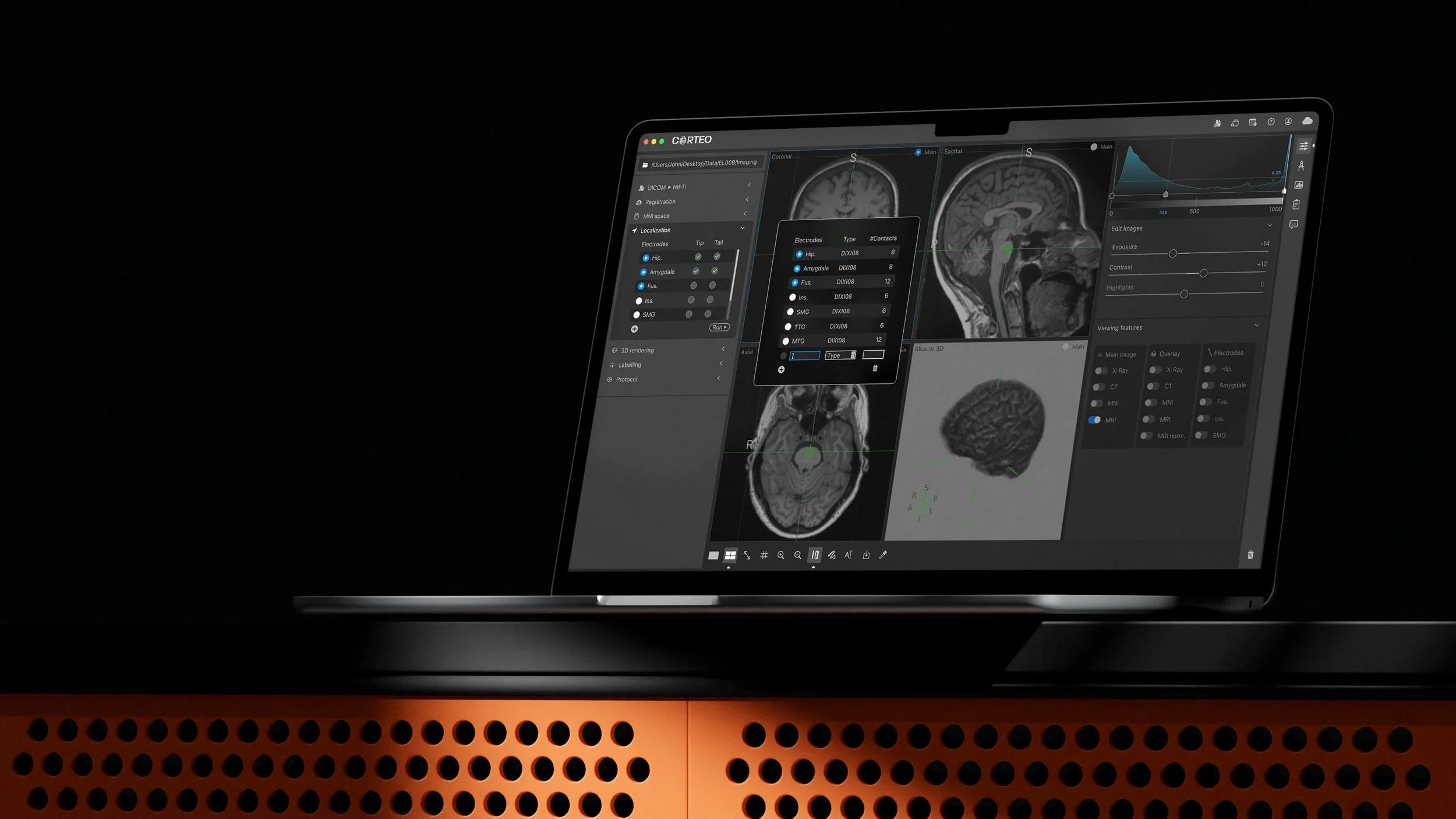 High-fidelity realistic mockup of the CORTEO neuroscience interface on a laptop, showcasing a complex multimodal data dashboard designed for clinical research and academic collaboration.