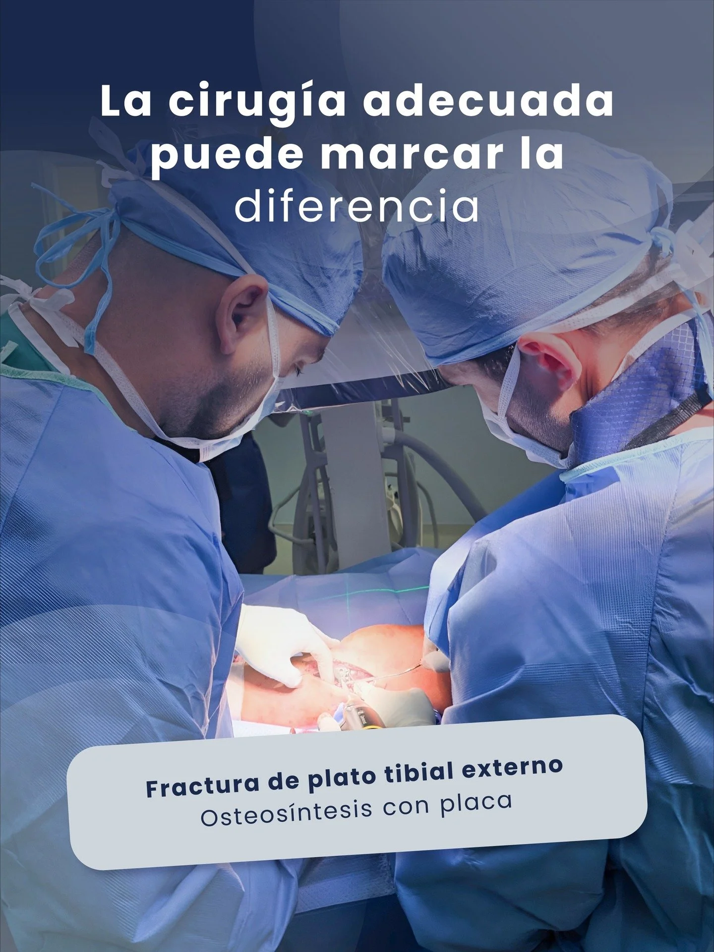 A veces todo cambia en un segundo&hellip; pacientes con una ca&iacute;da o un mal paso que ahora sufren de mucho dolor.

En esta fractura de plato tibial externo, nuestro paciente tuvo grandes complicaciones, dolor y poca movilidad.

Para solucionarl