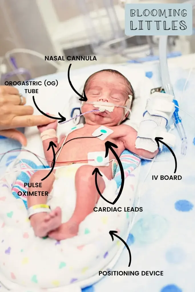 Your Baby is in the NICU: What Happens Next?