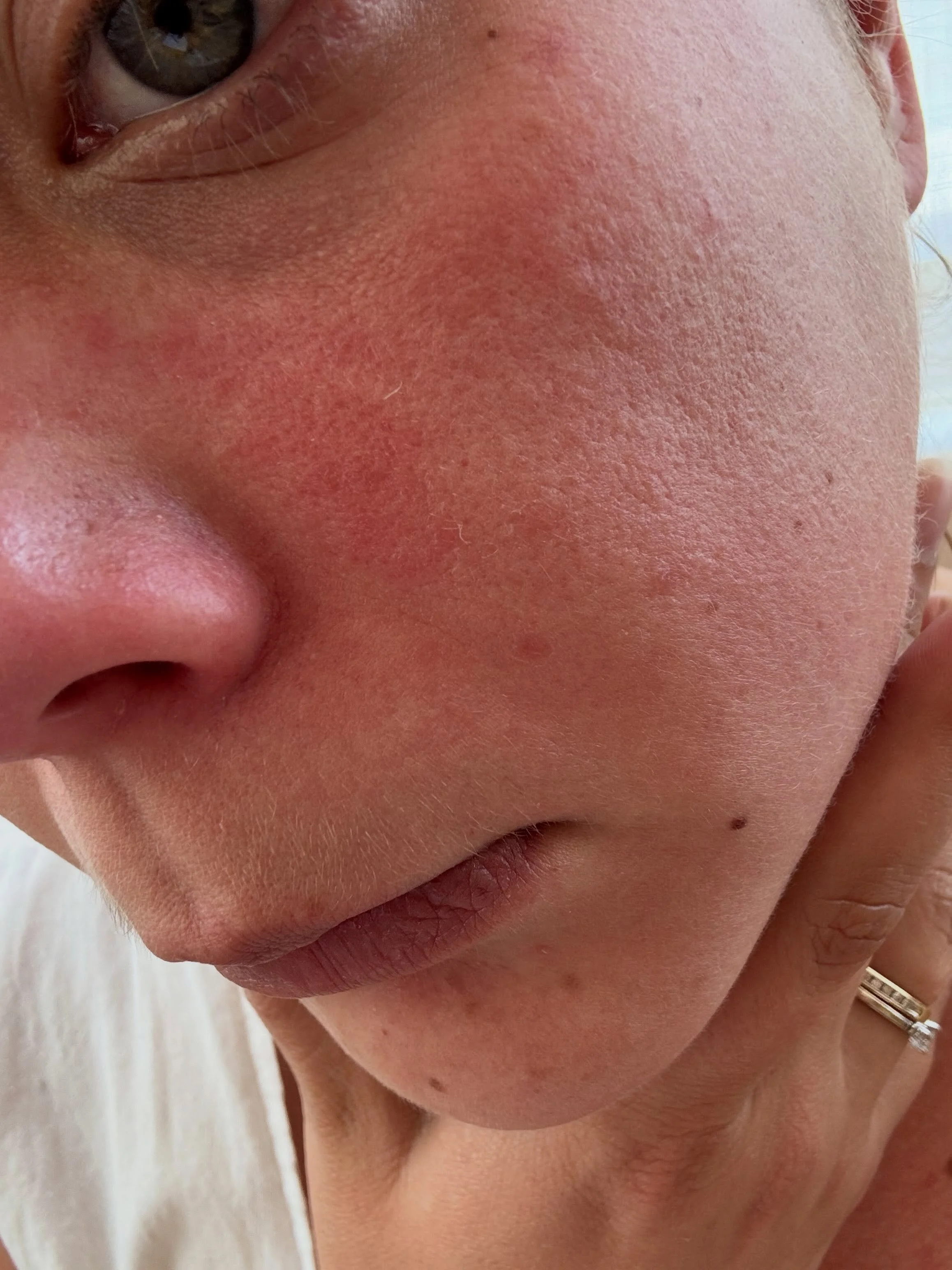 WEAR YOUR SUNSCREEN. This year at my annual dermatologist appointment I asked her to check out a spot on my face that I had been keeping an eye one because it looked irregular. No one but me noticed it but she took a look and said it could be precanc