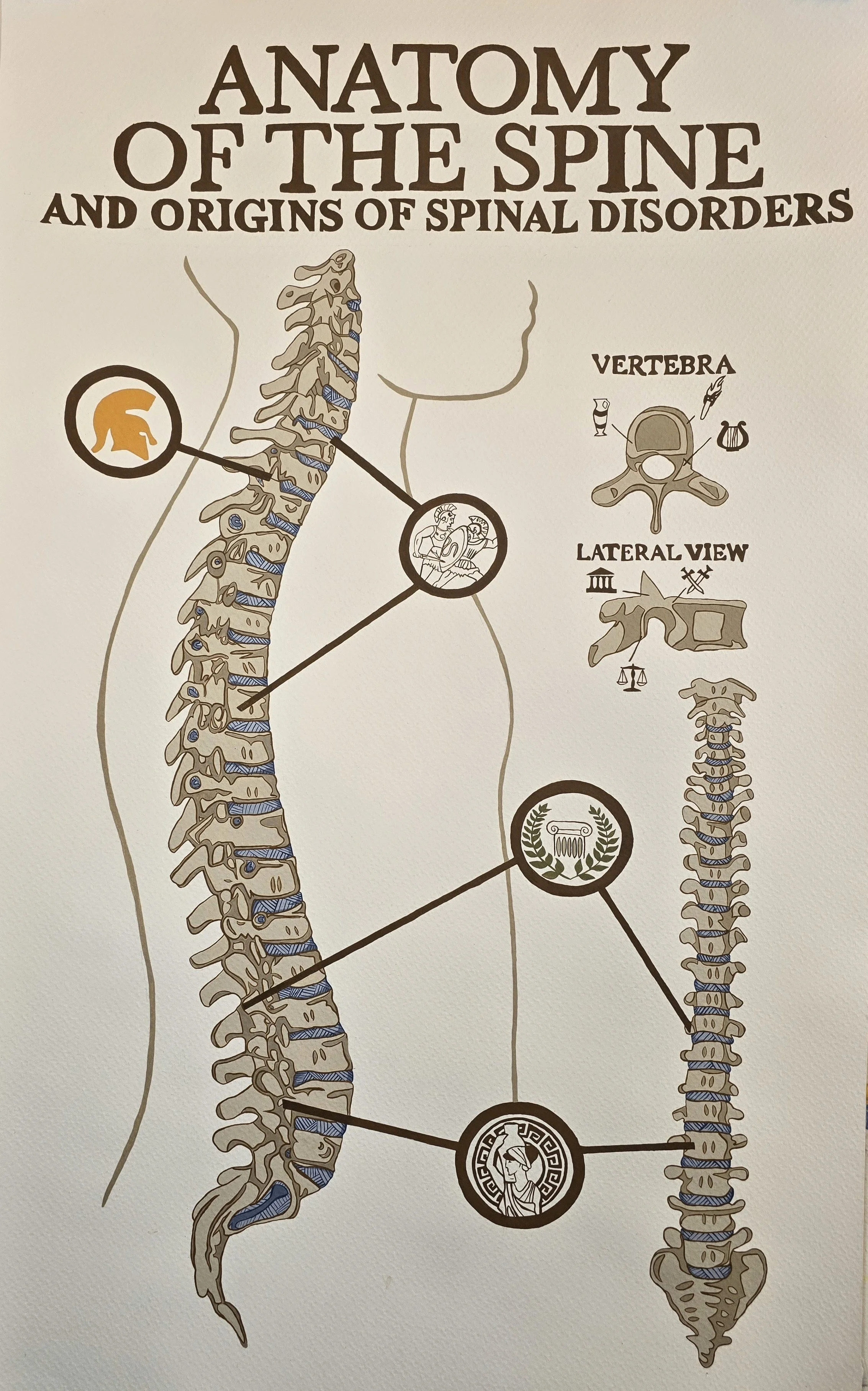 The Origin of Back Pain, gouache on paper, 20"x32"
