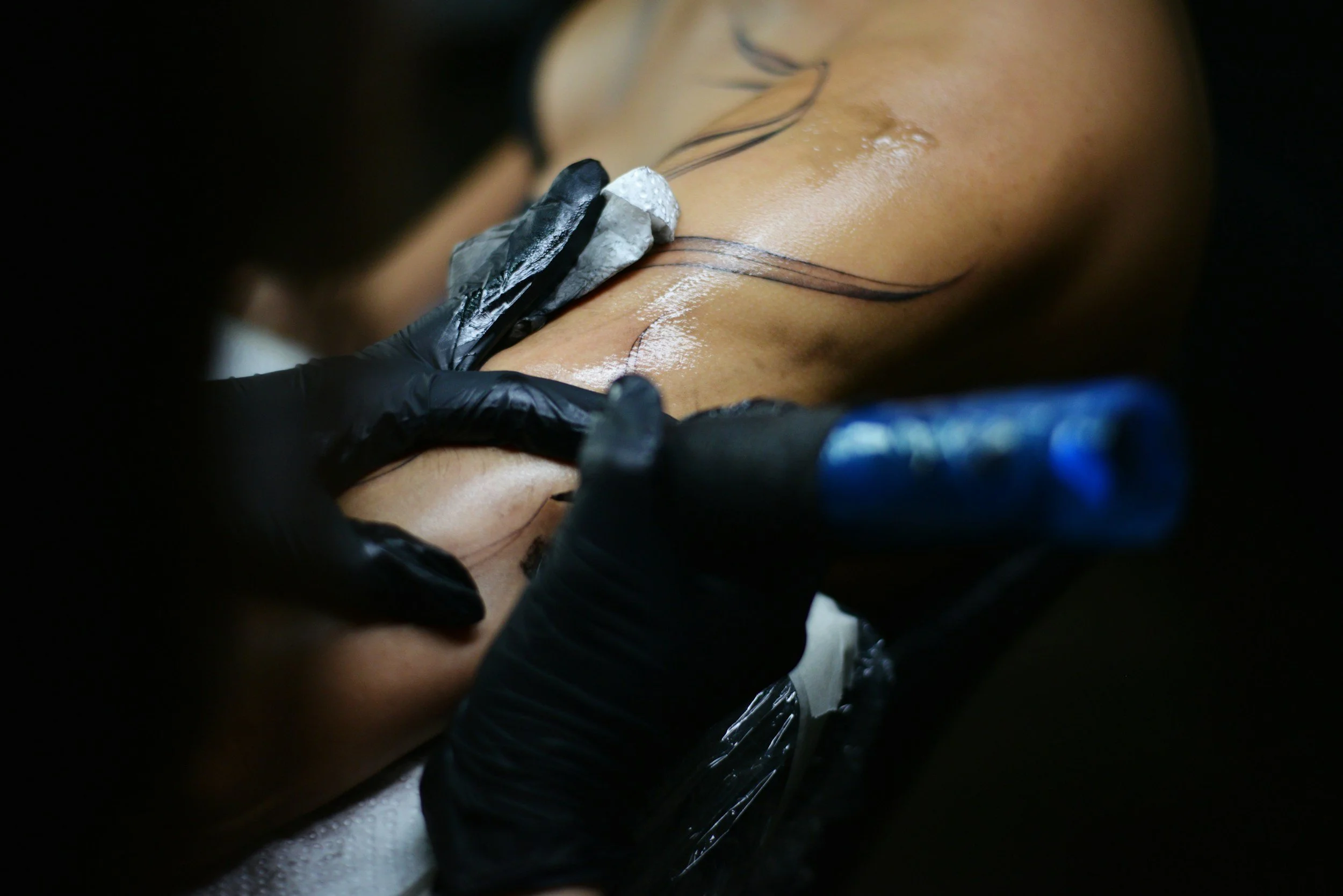 Pico Laser Tattoo Removal Certification Training