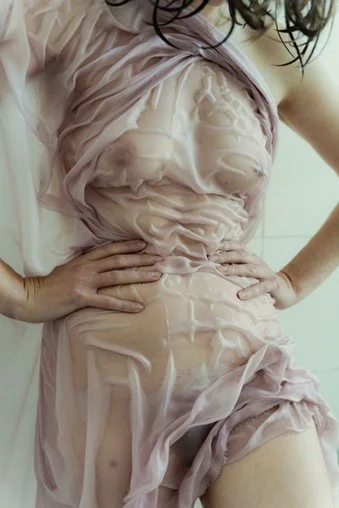 A person with visible skin deformities, possibly a medical condition, wearing a sheer fabric dress.