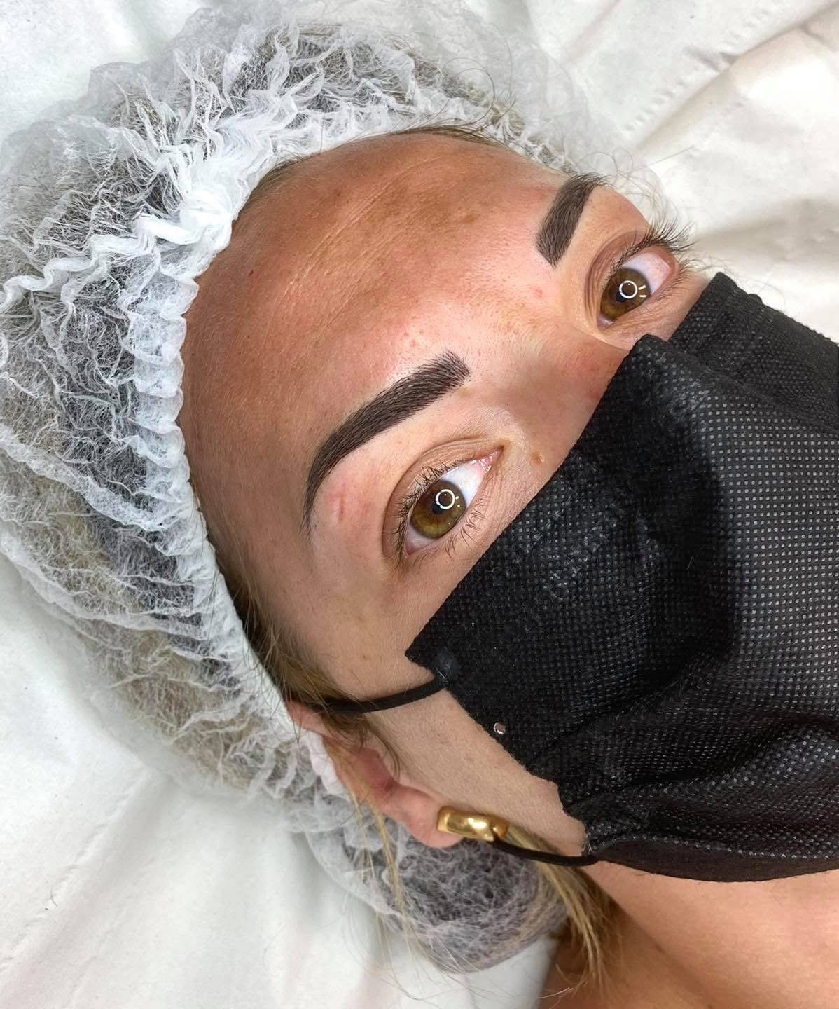 A woman lying down with a disposable hair cap, wearing a black face mask, has freshly done eyebrow microblading or permanent makeup.