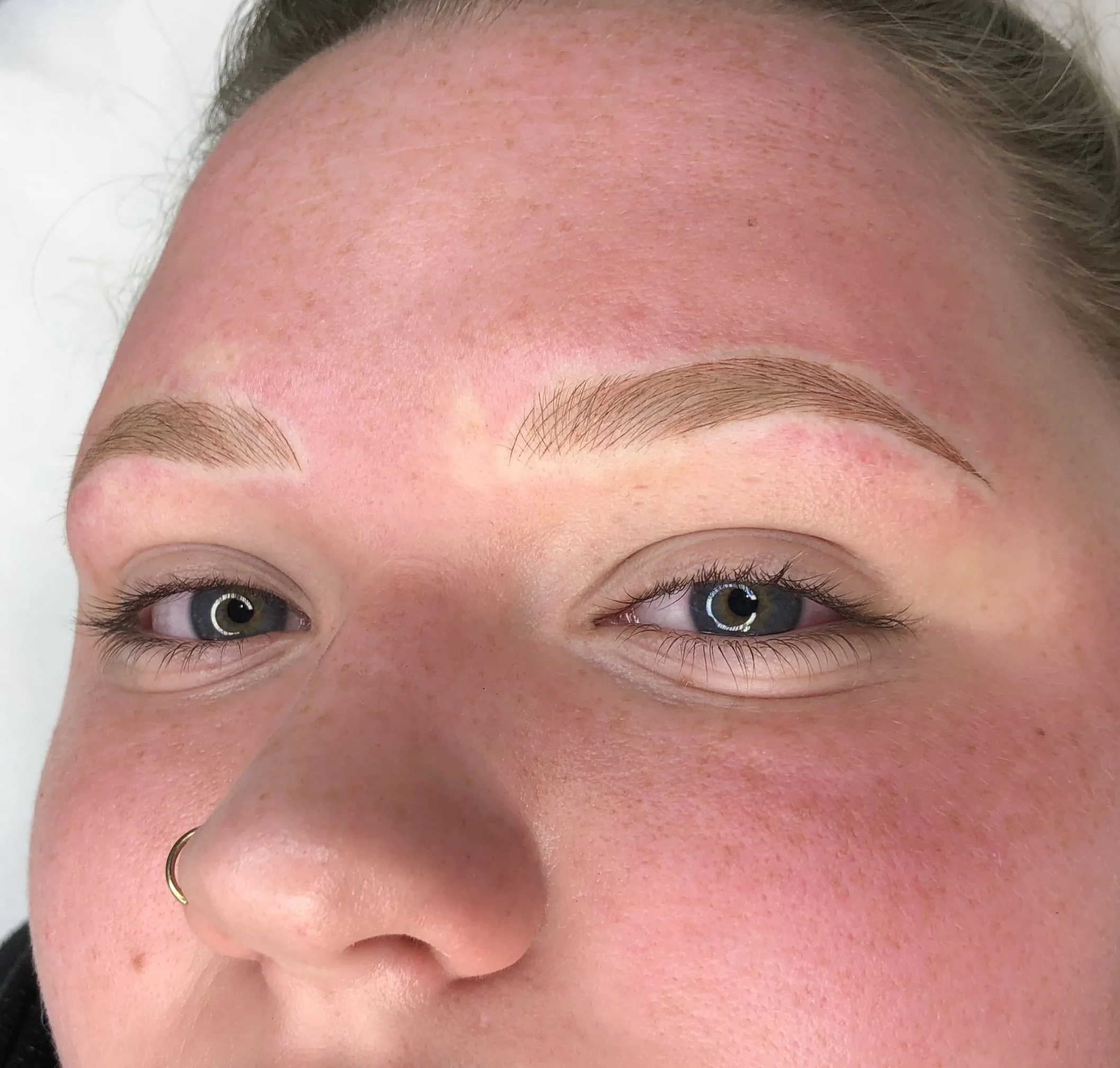 Trichotillomania Client After Microblading