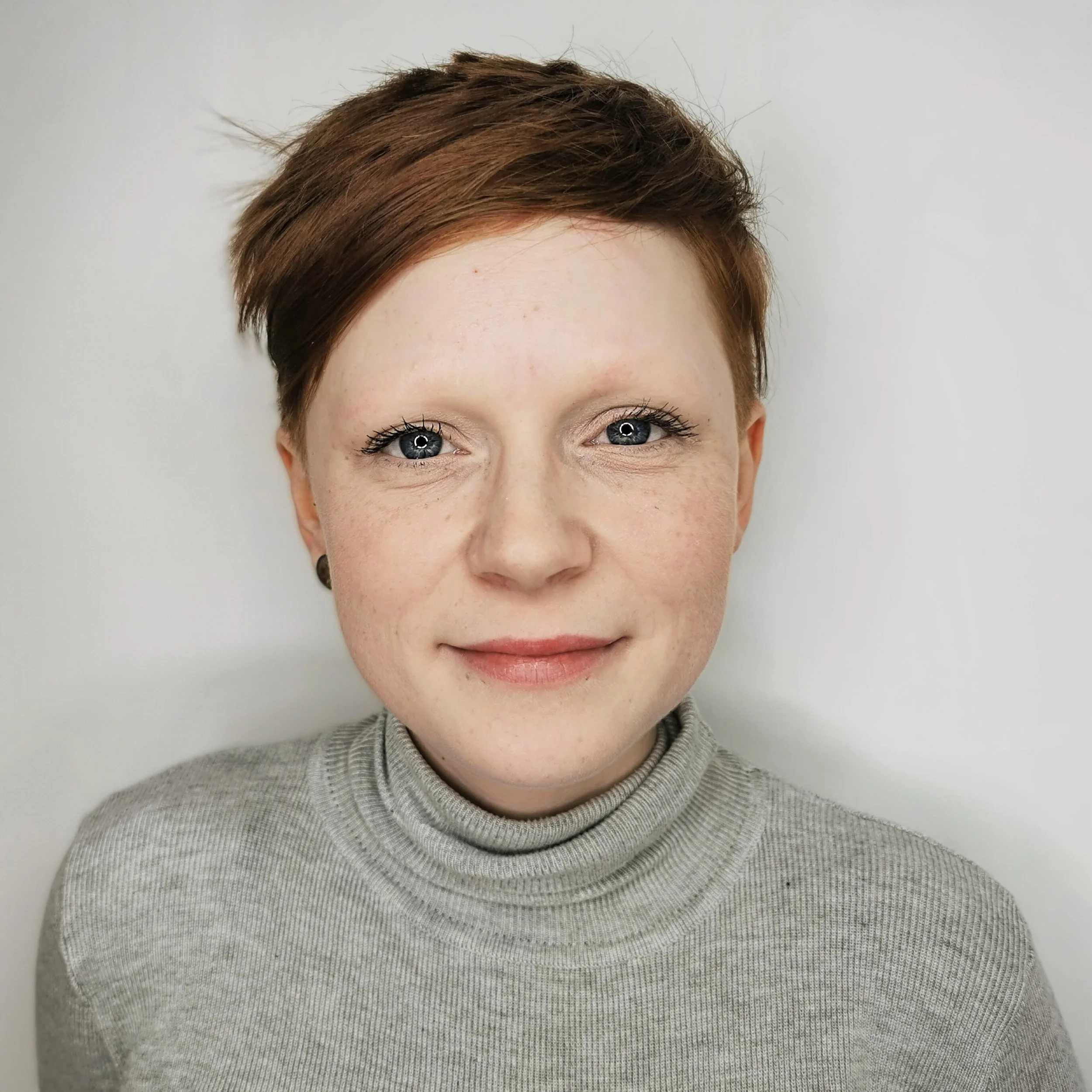 Alopecia Client Before Combination Brows