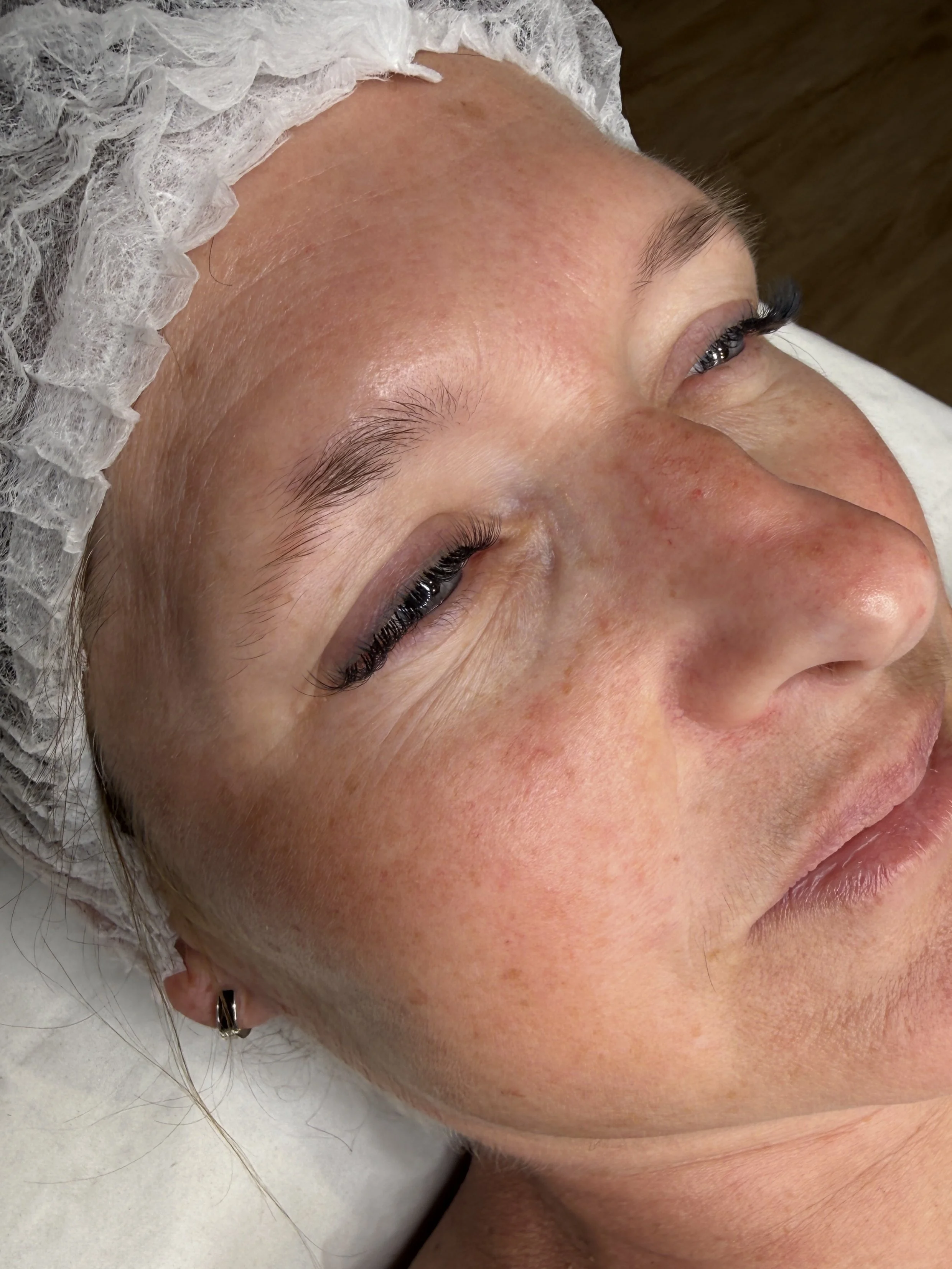 Before Combination Brows