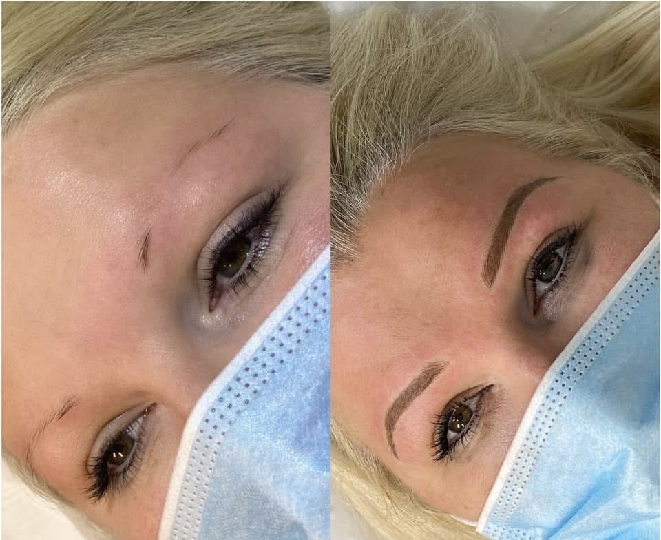 Side-by-side comparison of a woman's eyebrows before and after cosmetic enhancement, both wearing a blue medical mask.
