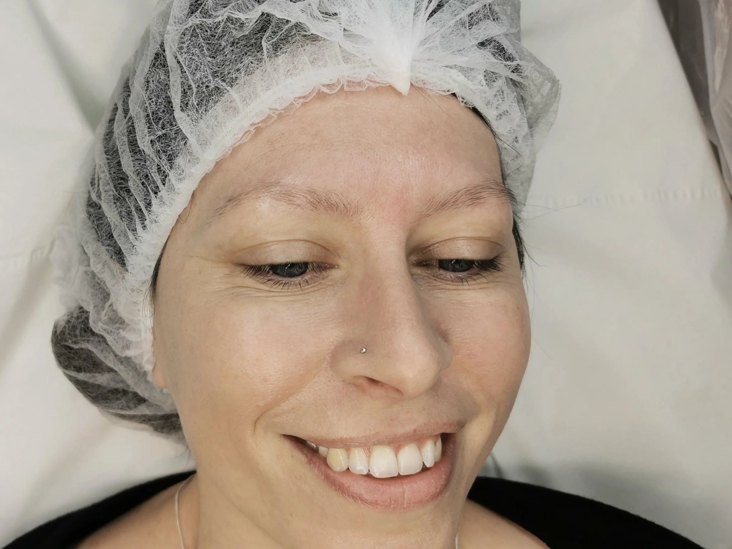 Before Microblading
