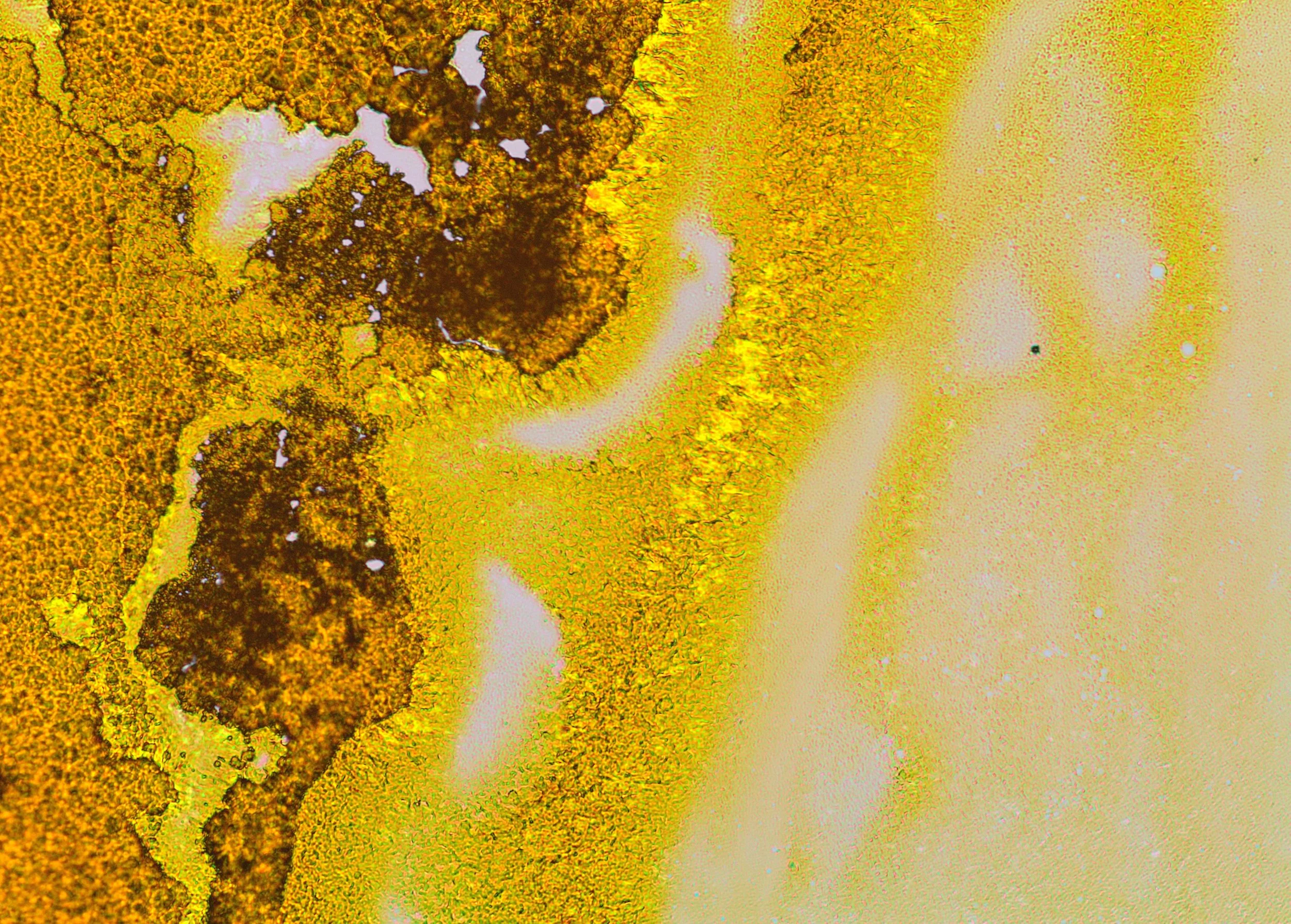 Distinct crystal morphology of riboflavin under a polarised microscope.