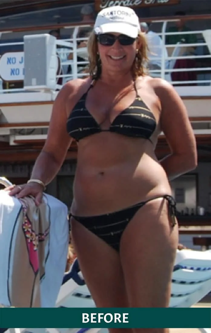 Smiling woman in a black bikini with gold stripes, wearing sunglasses and a white baseball cap, standing outdoors near boats.