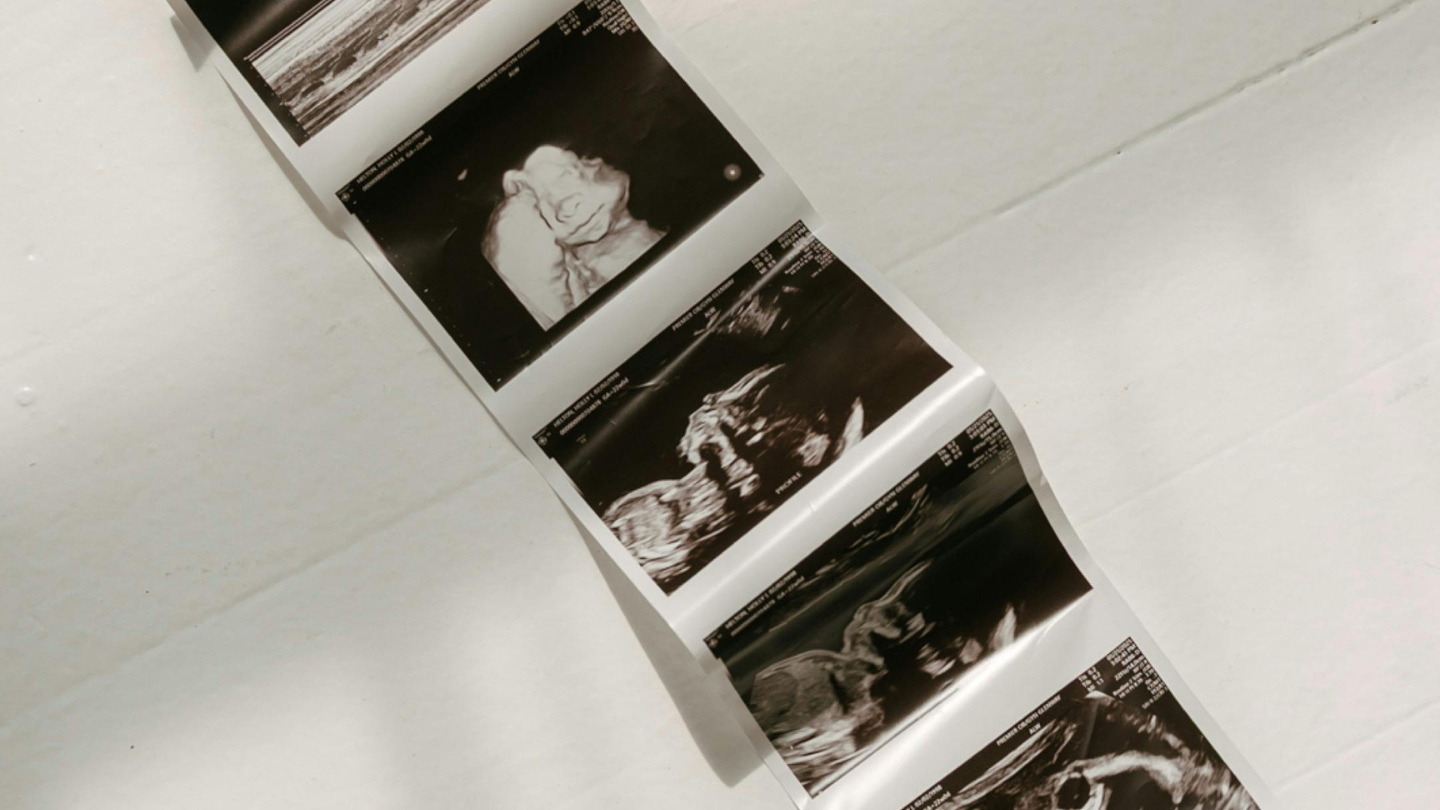 When Justice Stops at the Womb