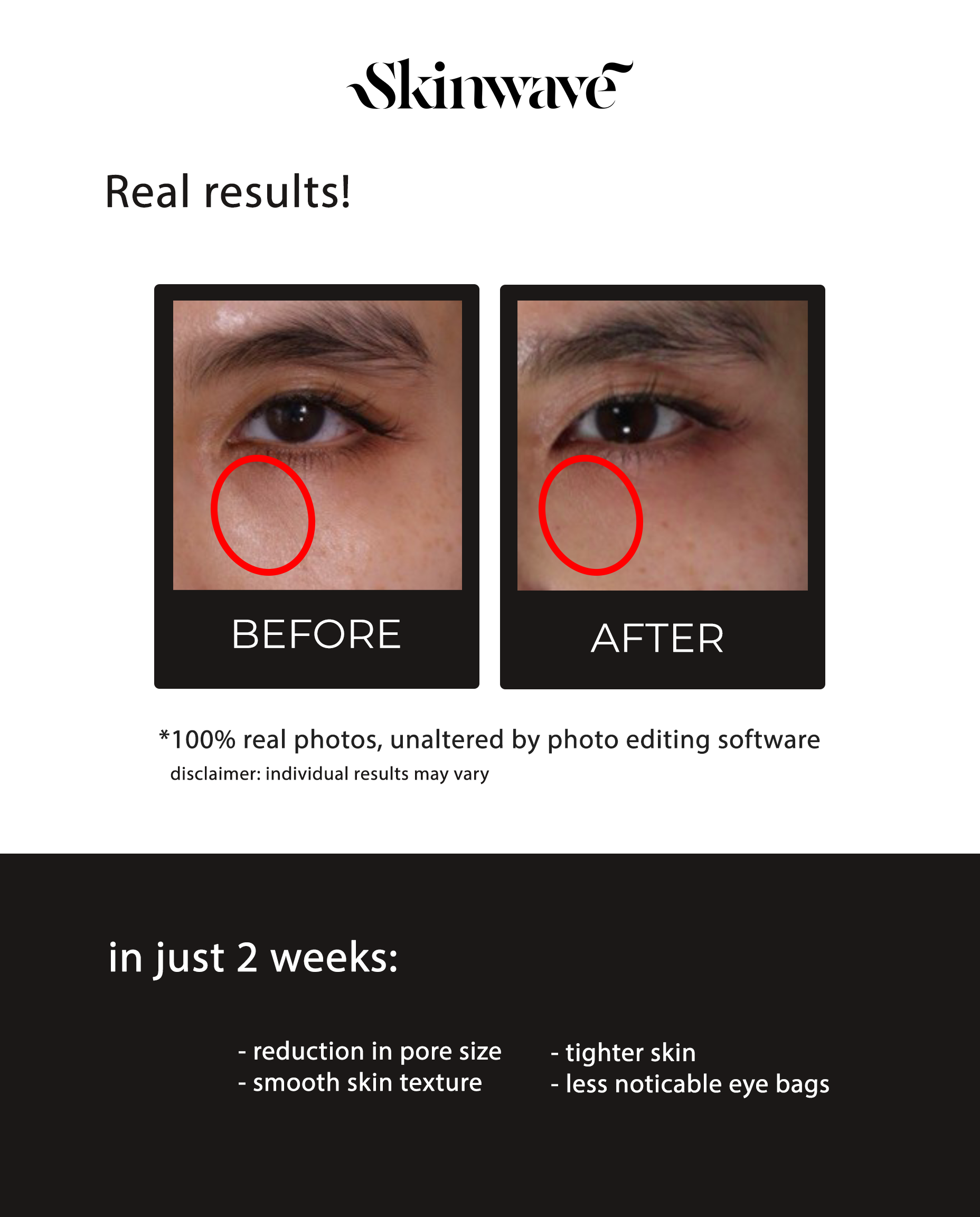skinwave before after2.png
