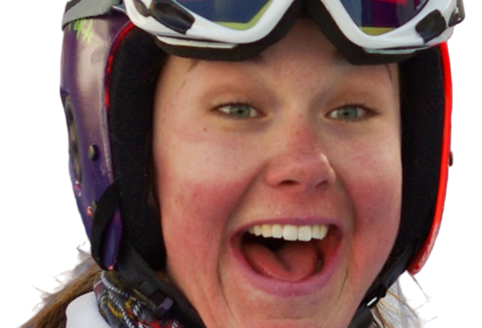 Skier's, Cyclists, Outdoor Professionals are exposued to intense UV light. Post care has proven to mitigate longterm skin damage.