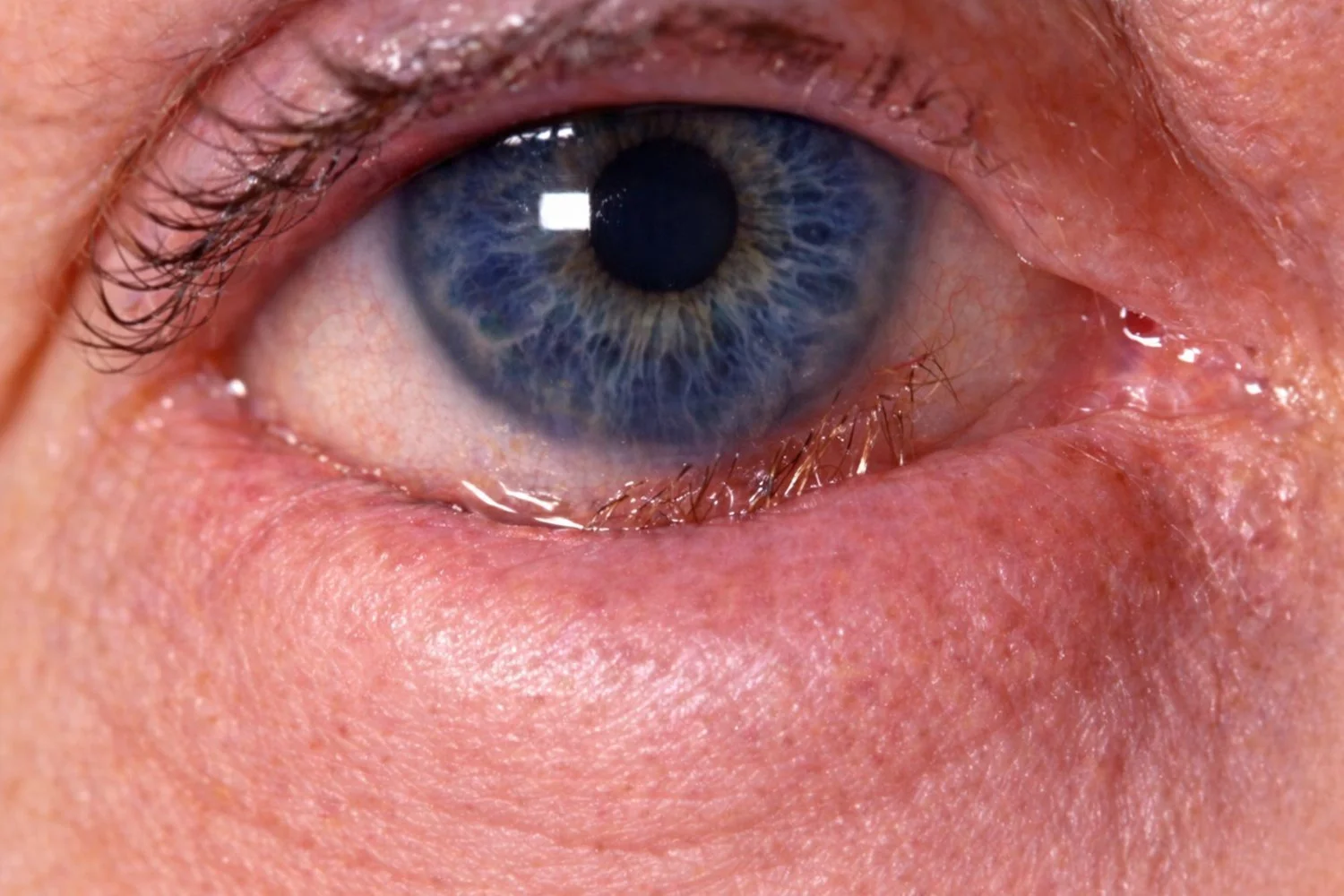 Close-up of a human eye with a blue iris and visible eyelashes, skin around the eye, and a reflection of light in the eye.