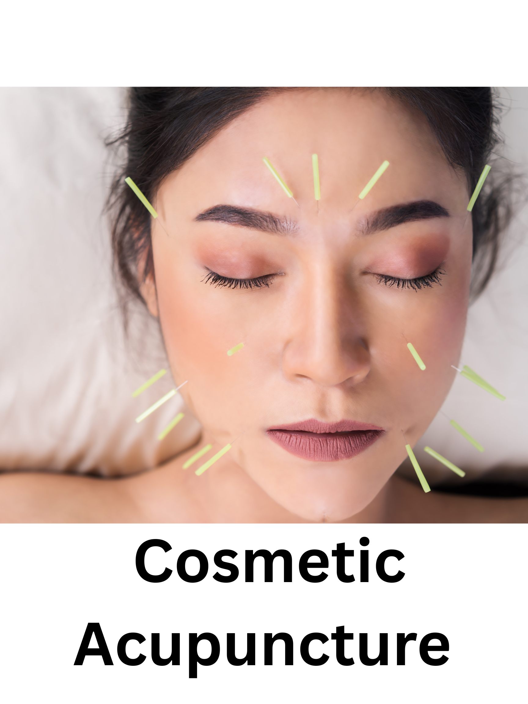 Cosmetic Acupuncture.png