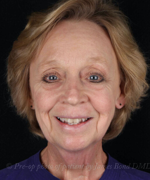 patient-01-after.jpg