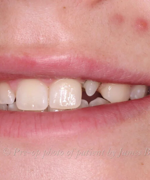patient-02-before.jpg