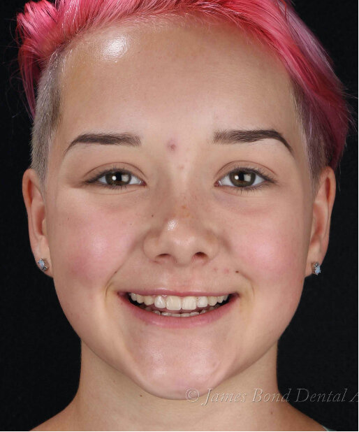 patient-02-after.jpg
