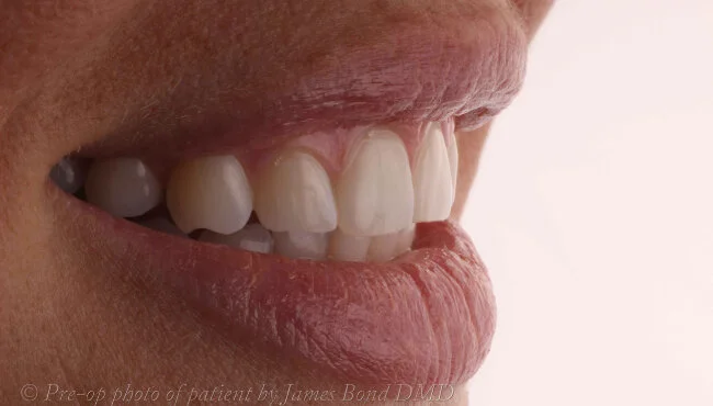 patient-03-before.jpg