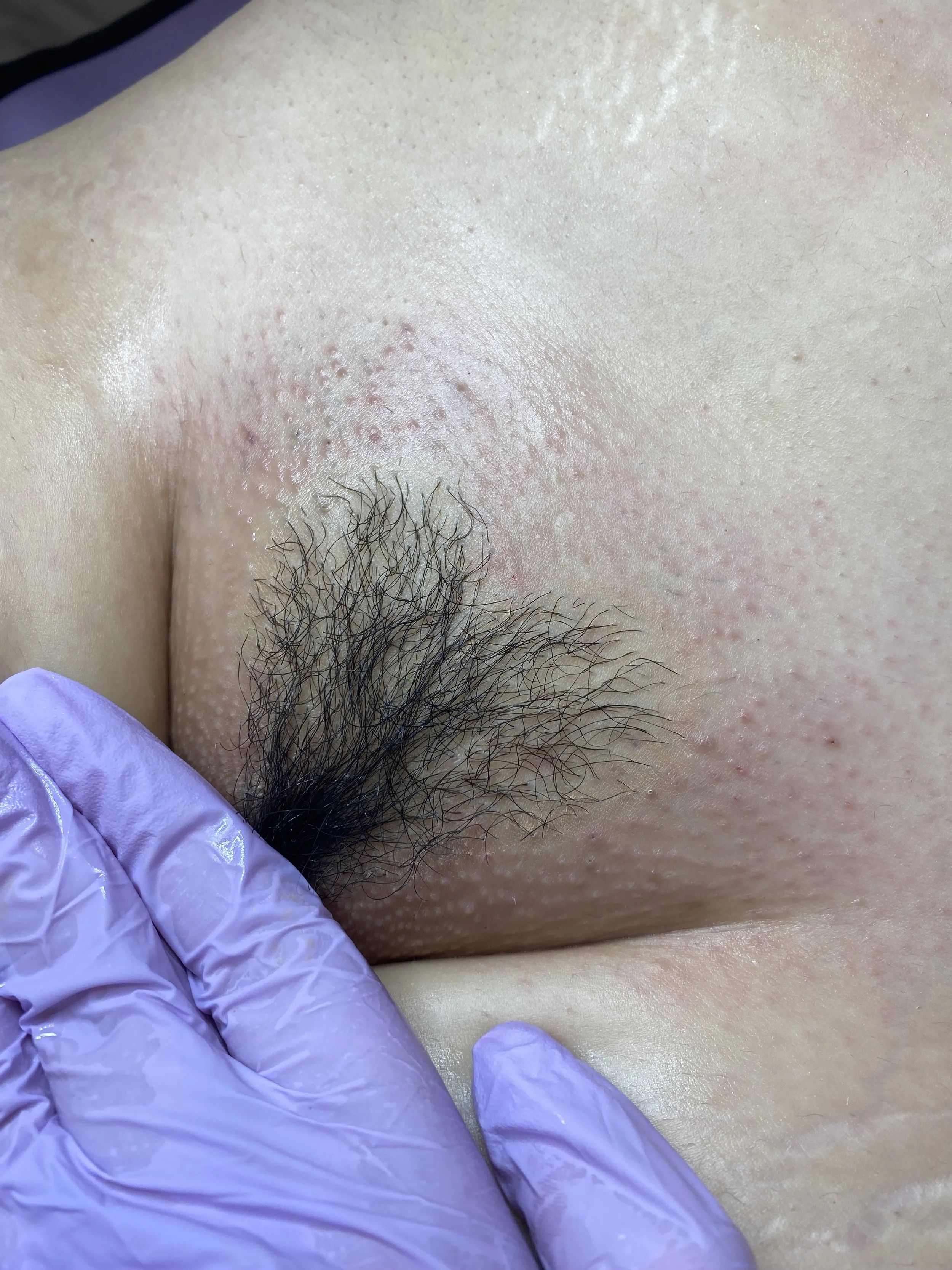 Brazlilian wax- Arlington, TX