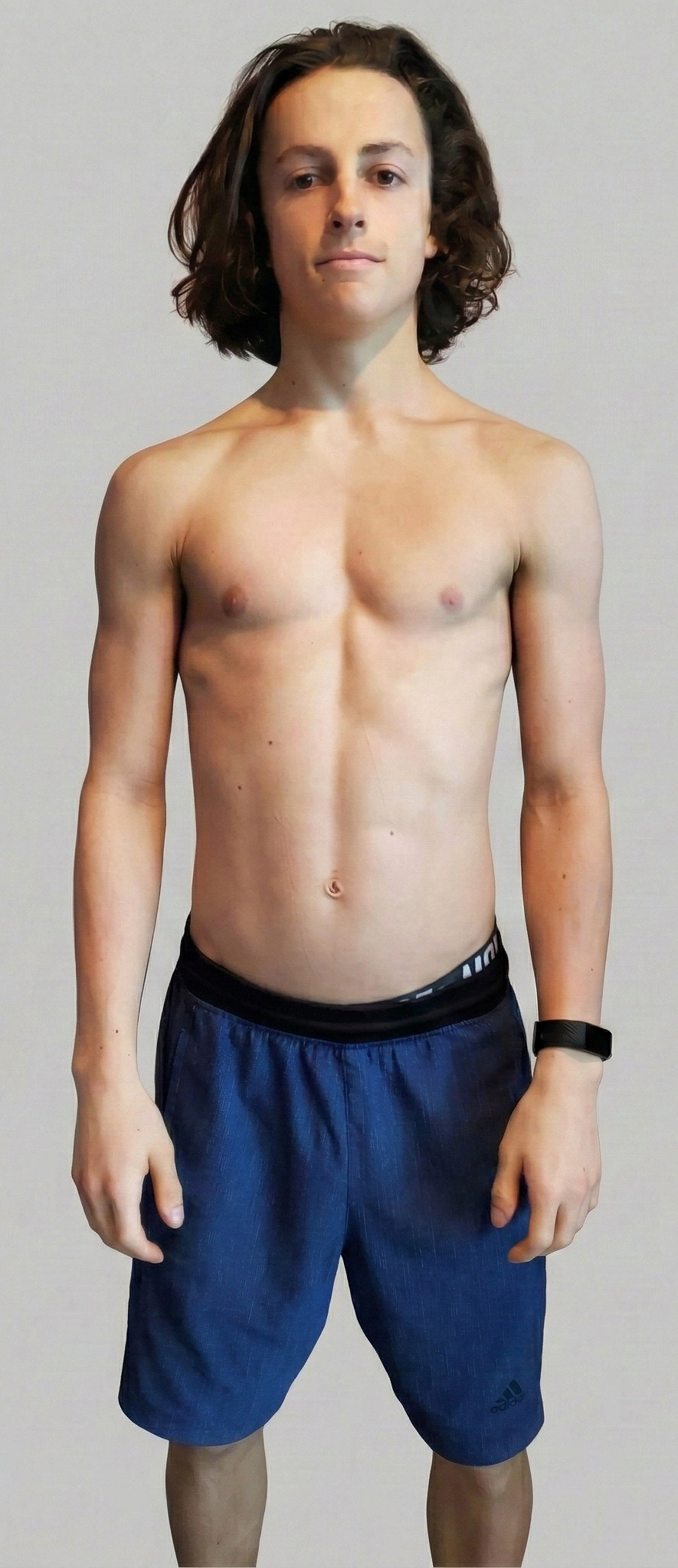 Felix Before
