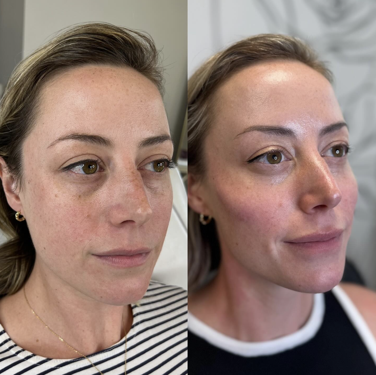 A beige ceramic vase with a narrow neck and rounded body on a wooden surface, with a sprig of dried flowers inside, illuminated by natural light and casting shadows on a white wall.