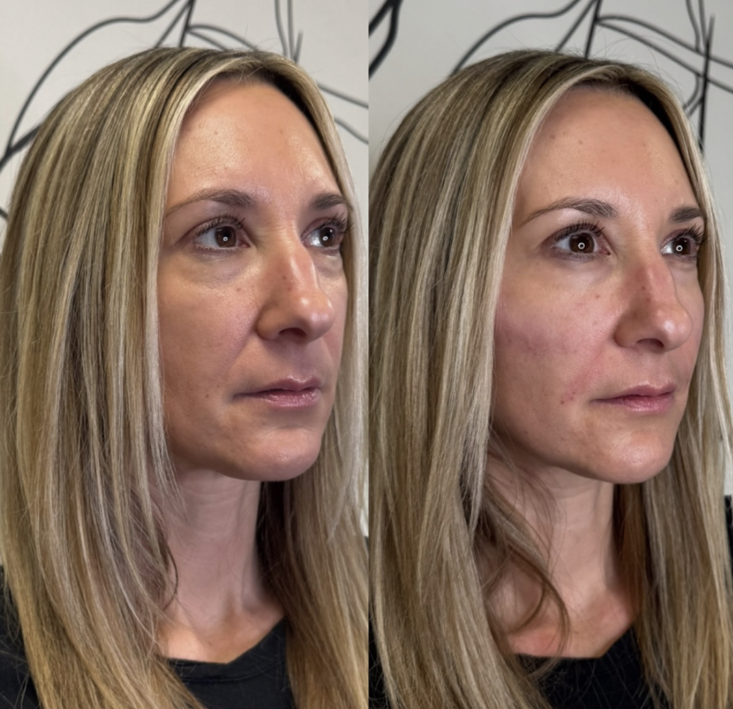 Two minimalist speckled ceramic vases, one with dried flowers, against a neutral background.