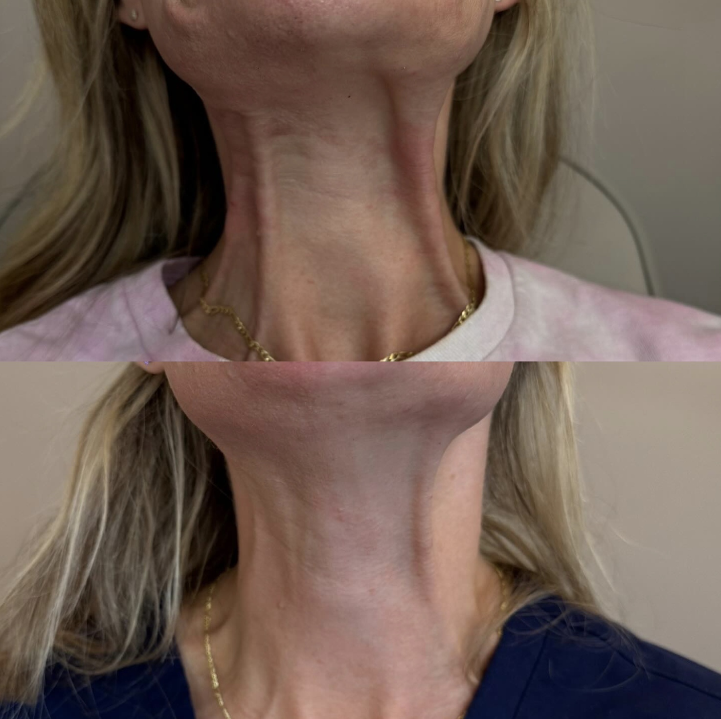 Two minimalist ceramic vases on a beige surface against a brown wall, one holding dried flowers and seed pods.