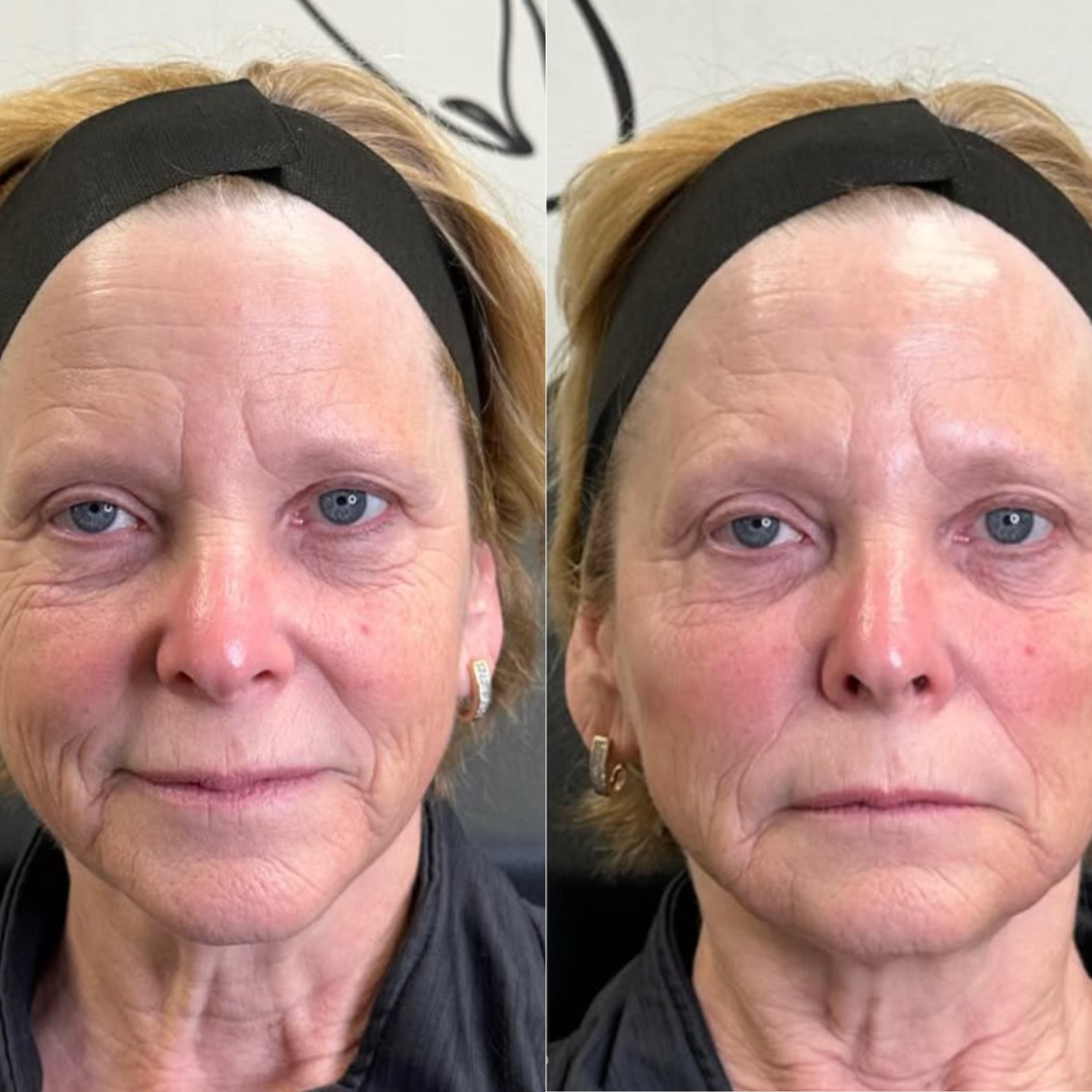 A beige ceramic vase with dried brown branches on a wooden surface, casting a shadow on a plain wall.