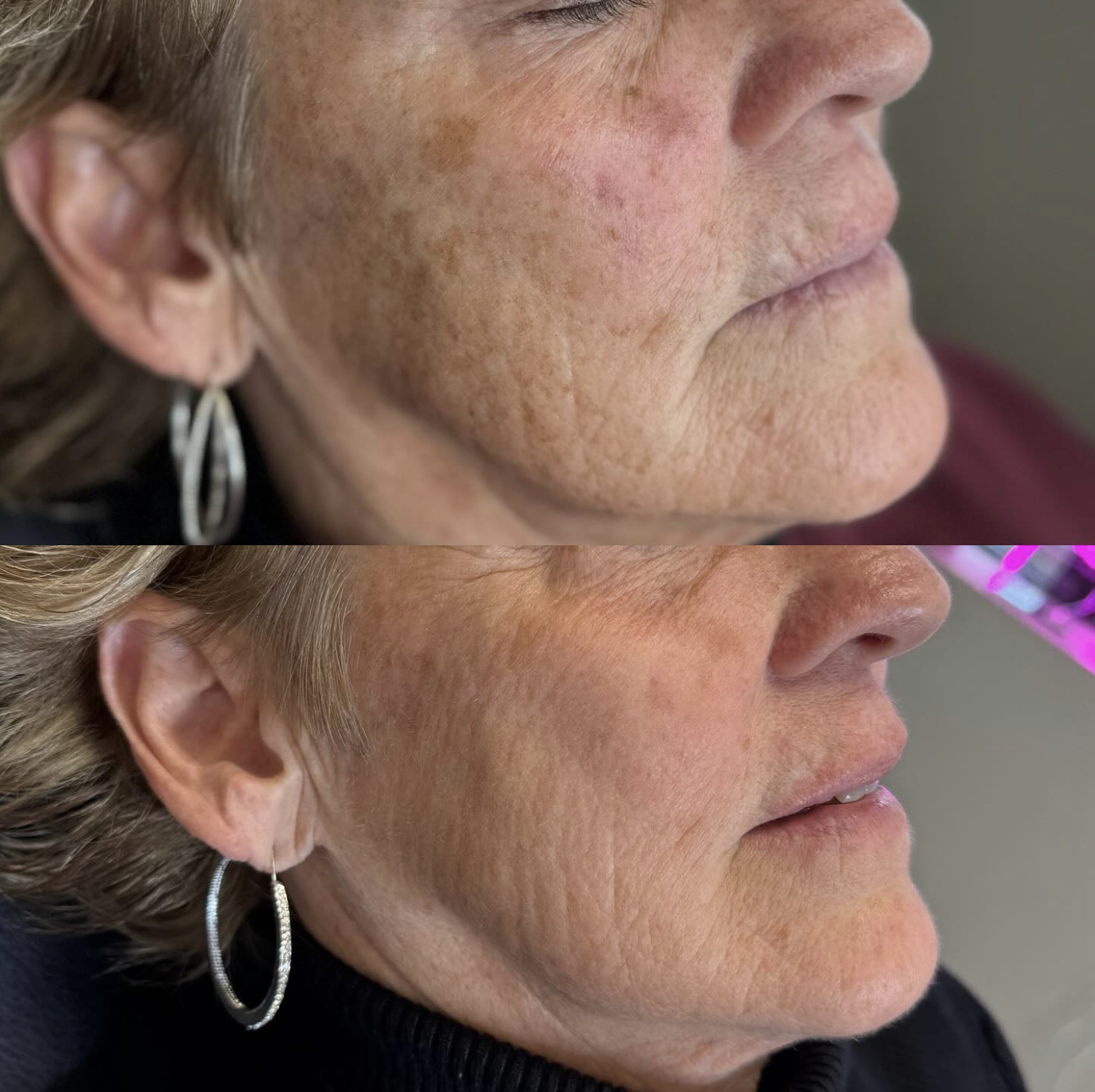 A beige ceramic vase with a narrow neck and rounded body containing dried branches on a wooden surface, casting a shadow on a plain white wall.