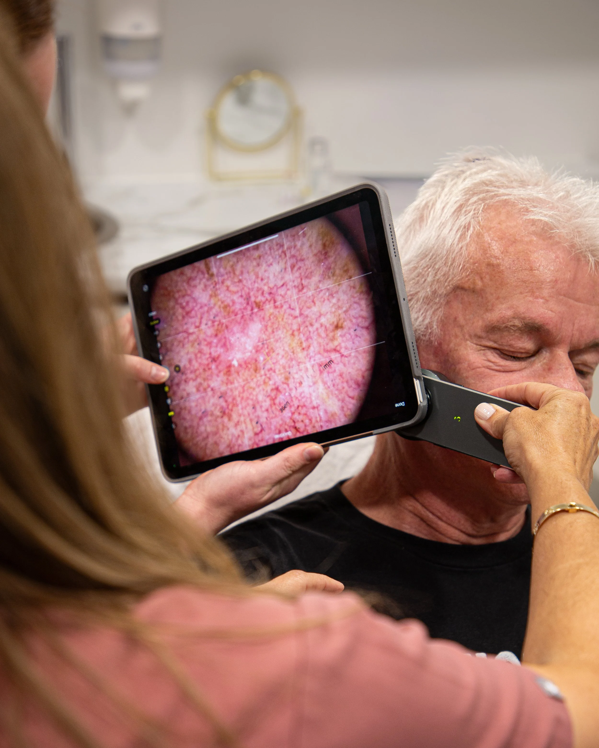 A healthcare professional using a digital dermatoscope to examine a senior man's scalp for skin issues, with a close-up view of the scalp on a digital screen.