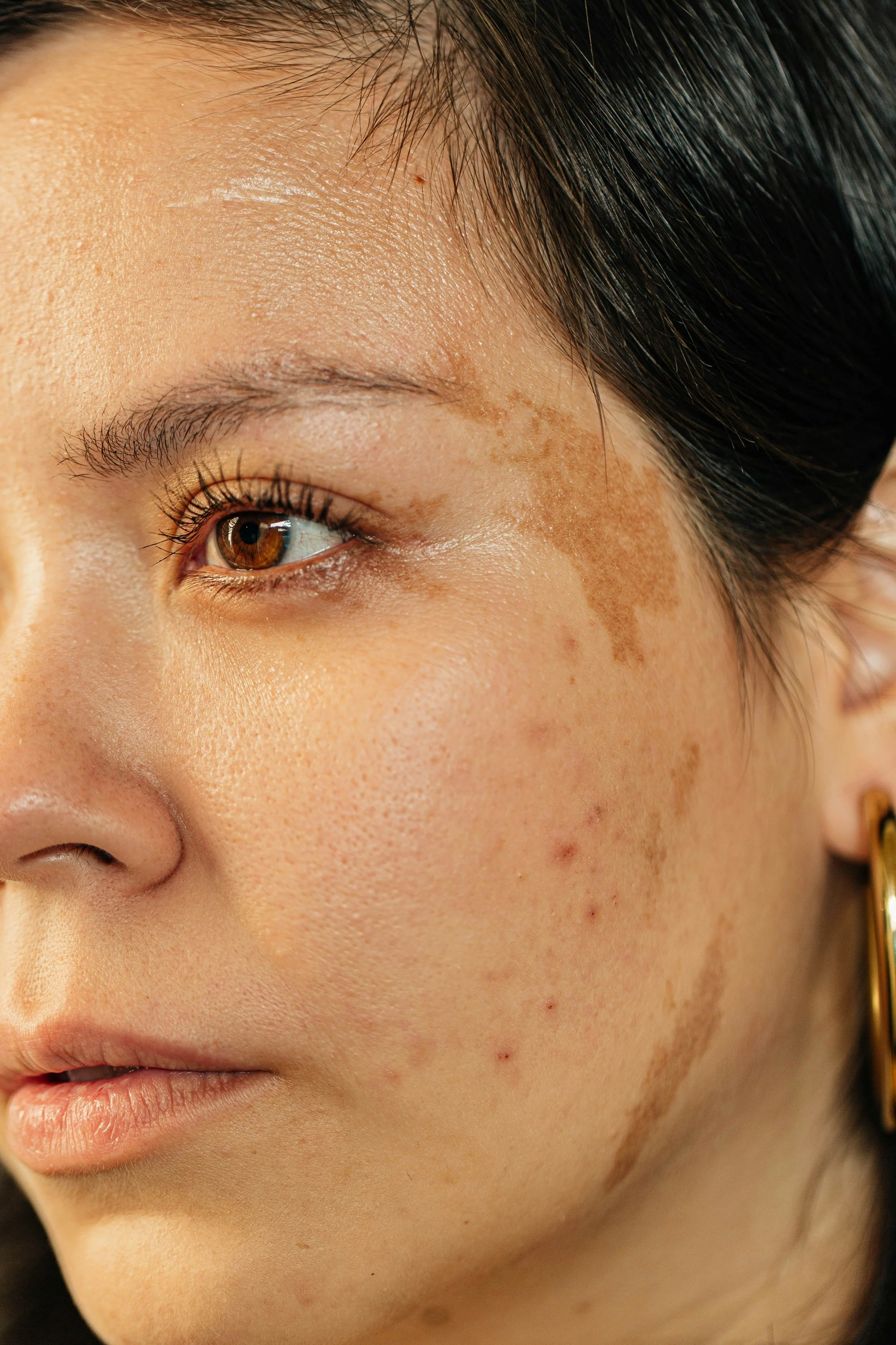 Close-up of a young woman's face showing detailed skin texture, brown eye, and dark hair.