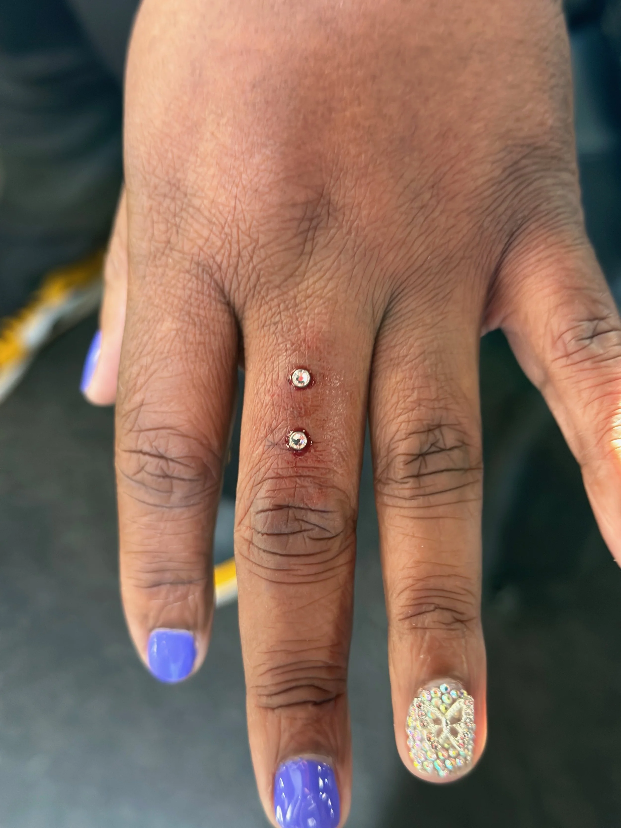 Close-up of a person's hand with two small dermal piercings on the middle finger and a decorative acrylic nail on the ring finger. The skin appears slightly red around the piercings.
