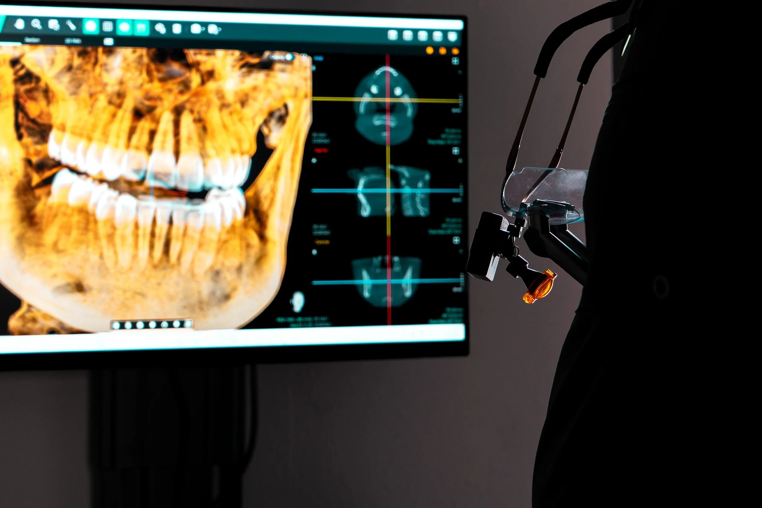 XRay_2.jpg