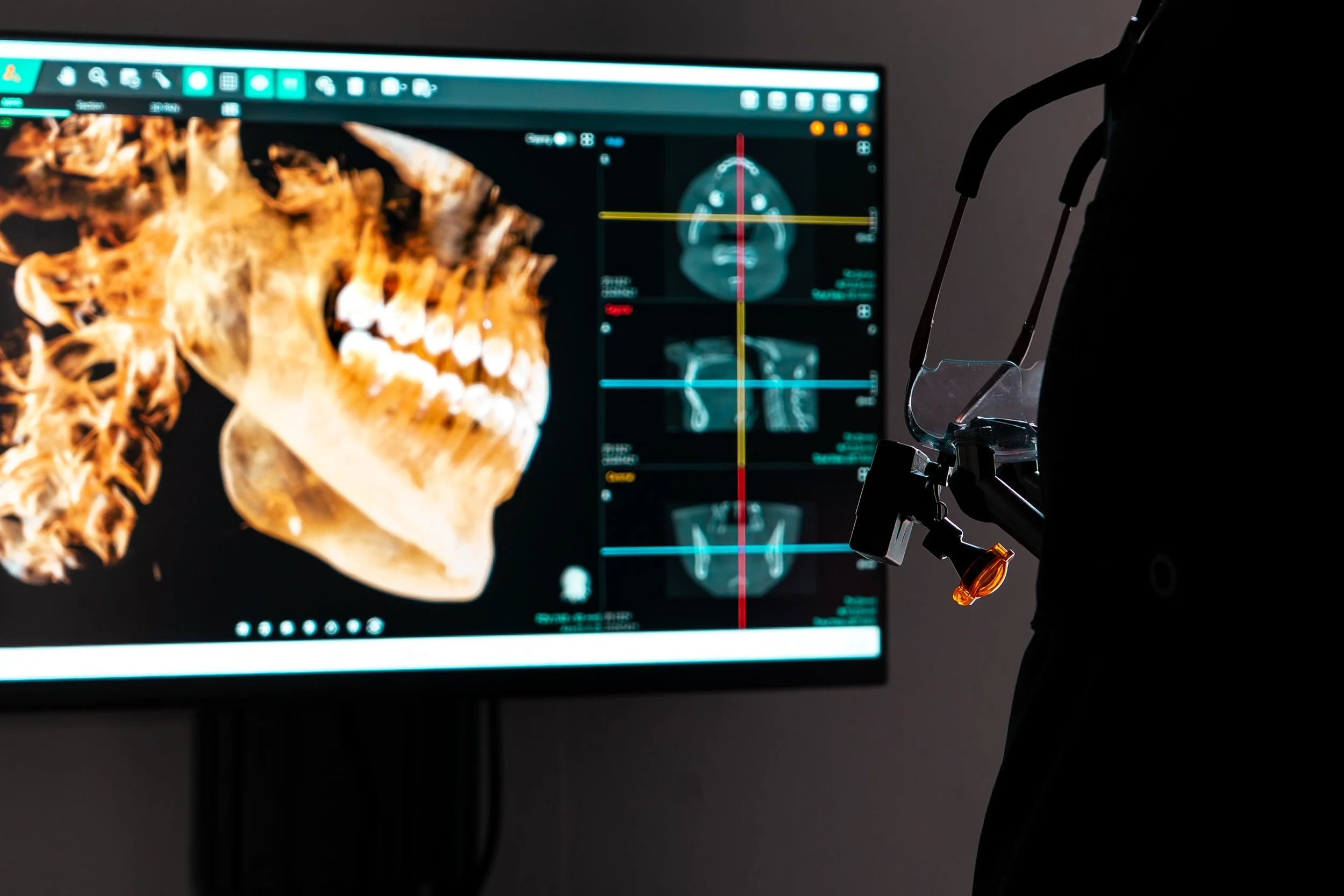XRay_1.jpg