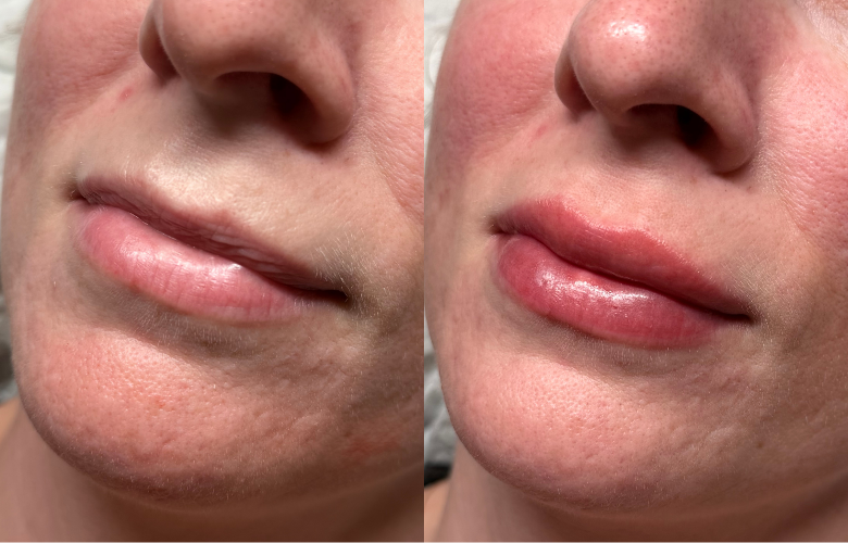 Lips.png