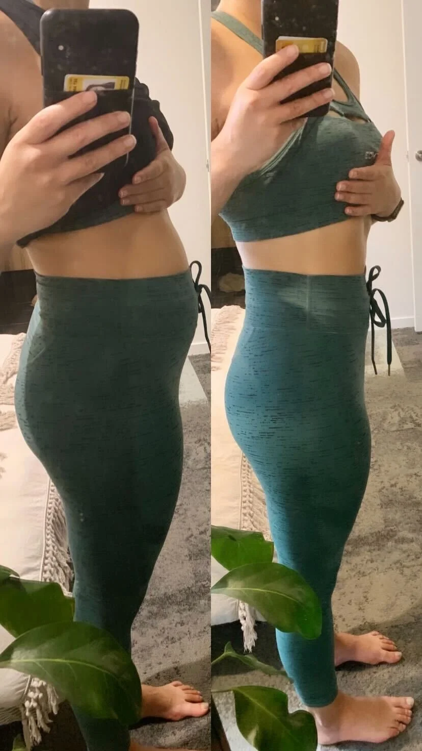 Dietitian Tips to Ease and Prevent Bloating