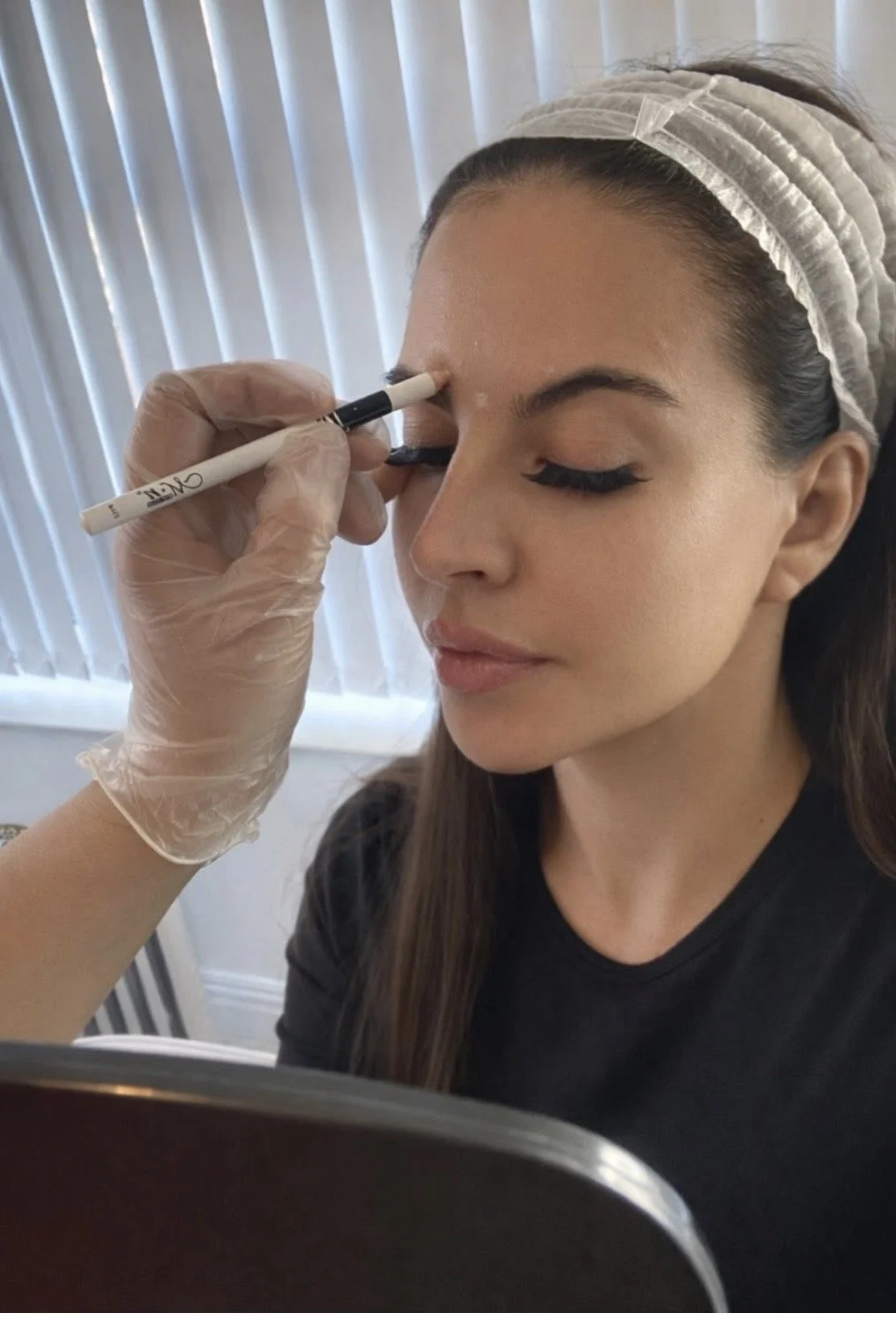 Botulinum toxin injection being administered across the forehead to relax horizontal lines at a medical aesthetics clinic
