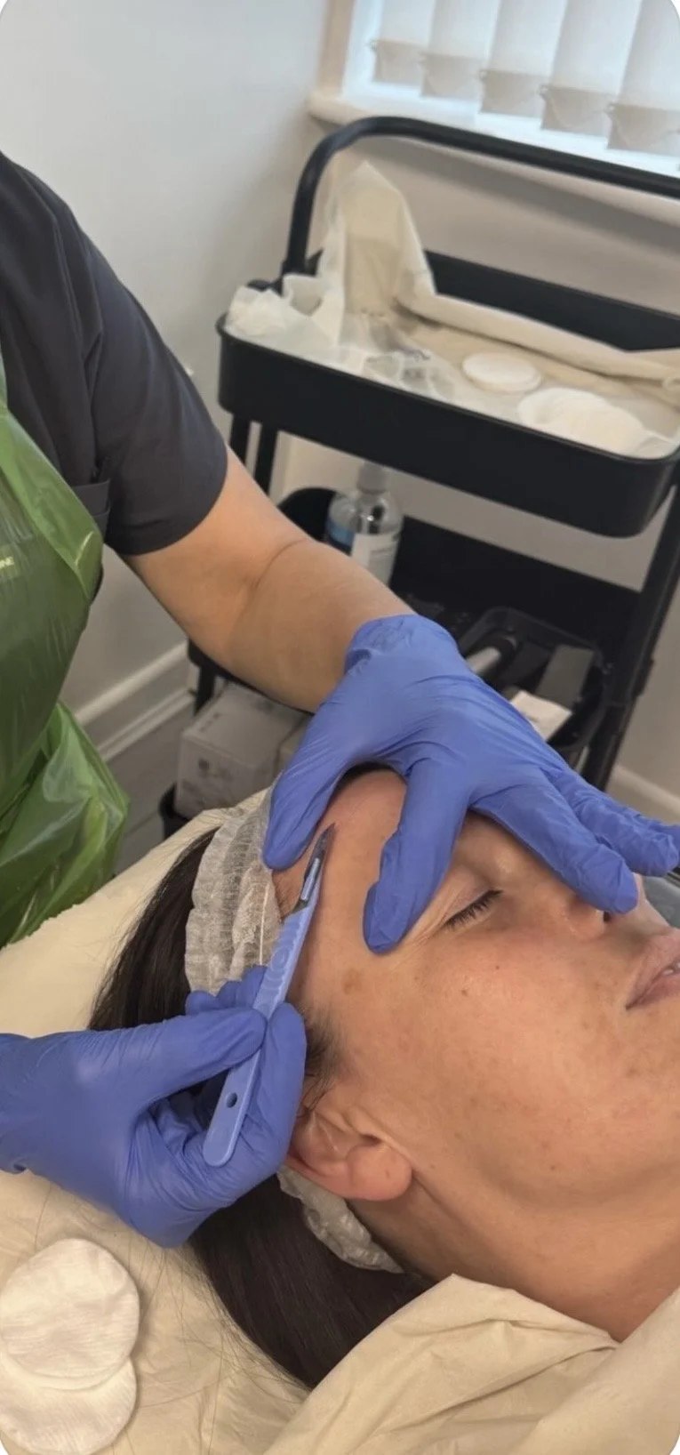 Aesthetician performing a full face dermaplaning treatment using a sterile surgical scalpel to exfoliate the skin at a medical aesthetics clinic