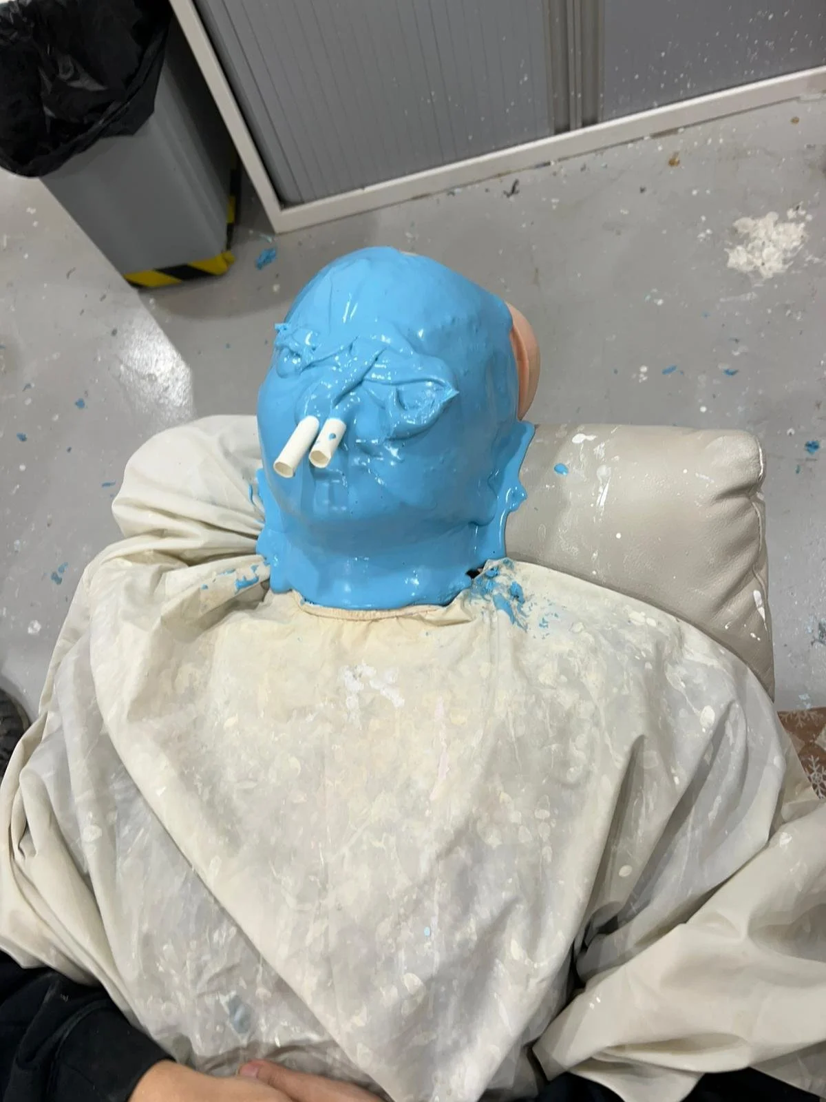 Alginate face cast