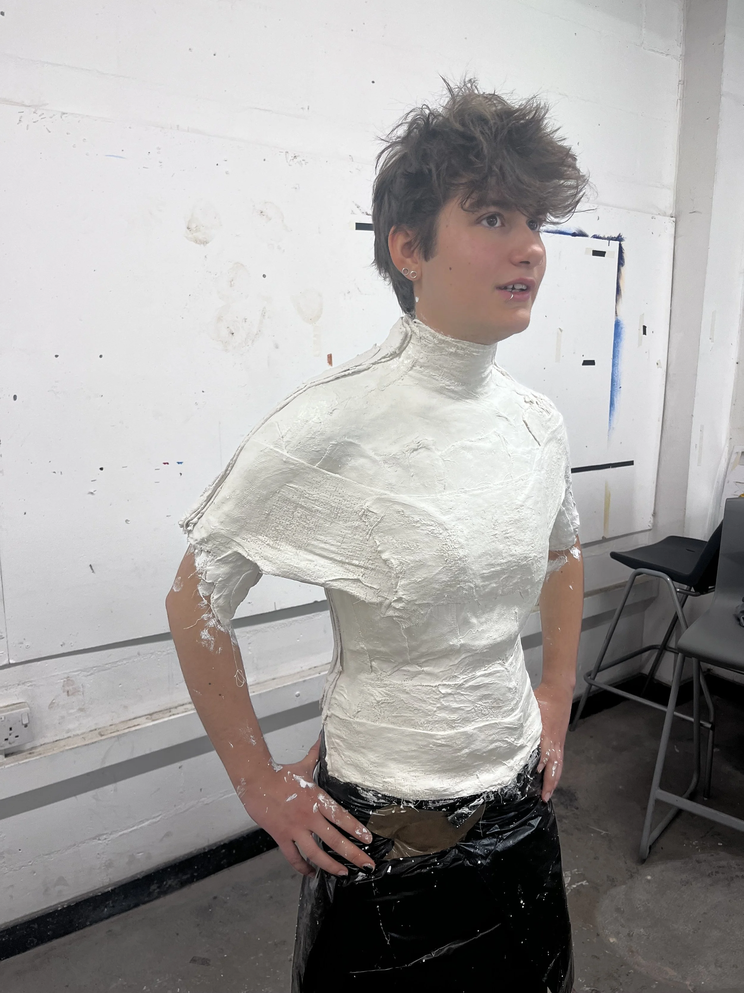 Torso cast using plaster bandage