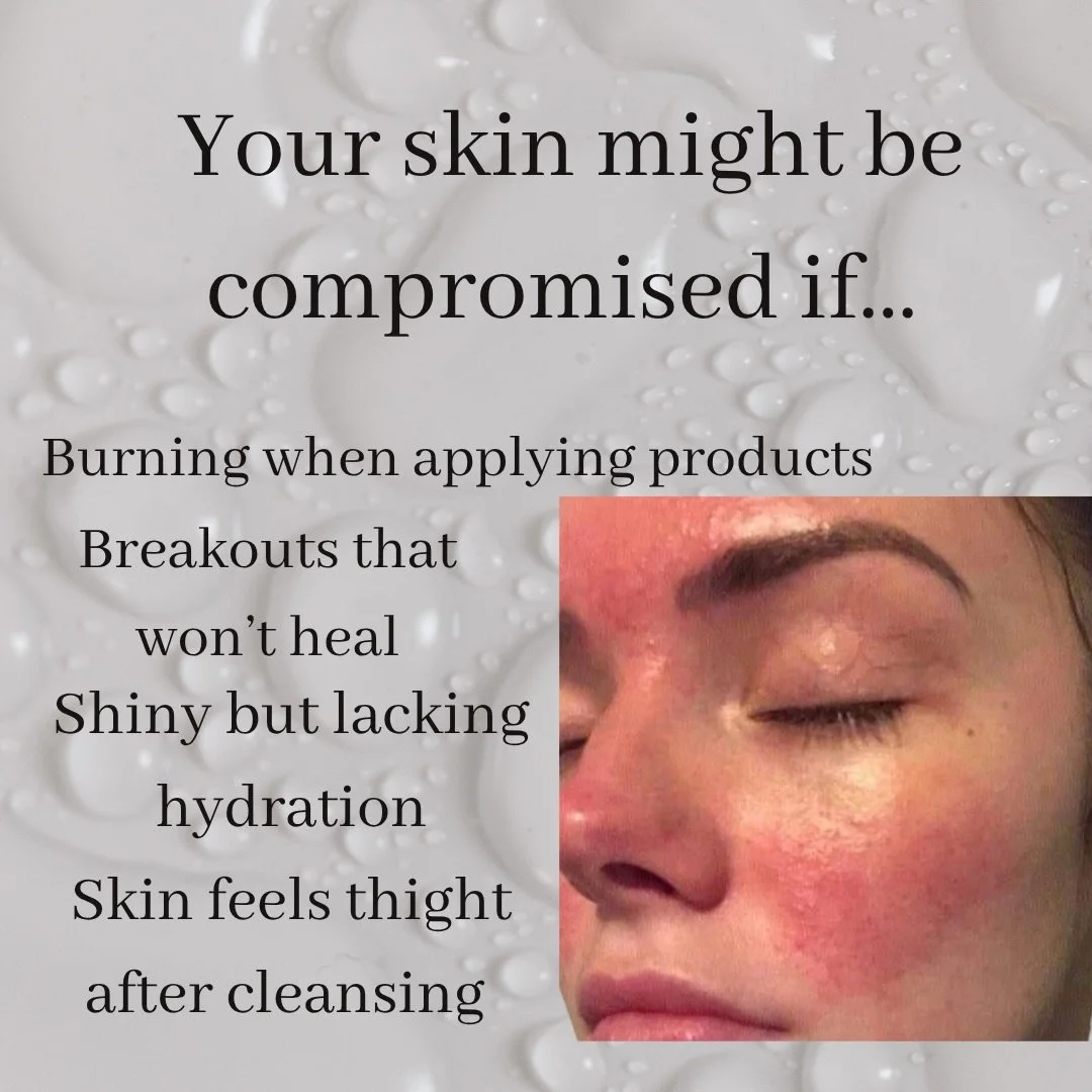 Barrier repair essentials #acneconsultation #abqskincare #estheticiannearme