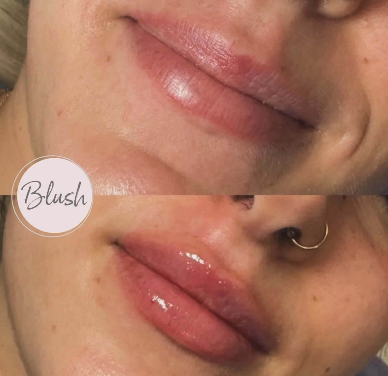 This is your sign to get your lips done for spring 🌸

📍117 Charing Cross St, Brantford ON
📞 519-304-3335
💌 info@blushmedicalaesthetics.ca 

#lipfiller #brantfordmedispa #springrefresh #naturallips #brantfordnurseinjector