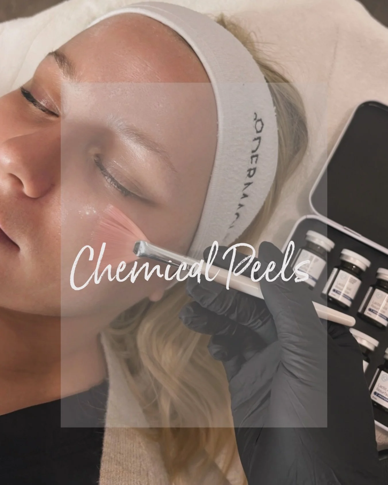 Chemical peels are one of the most effective ways to refresh and reset your skin.

By gently removing dead skin cells, we stimulate cell turnover to improve:
 ✔️ Acne + congestion ✔️ Fine lines ✔️ Hyperpigmentation ✔️ Uneven texture

Customized to yo