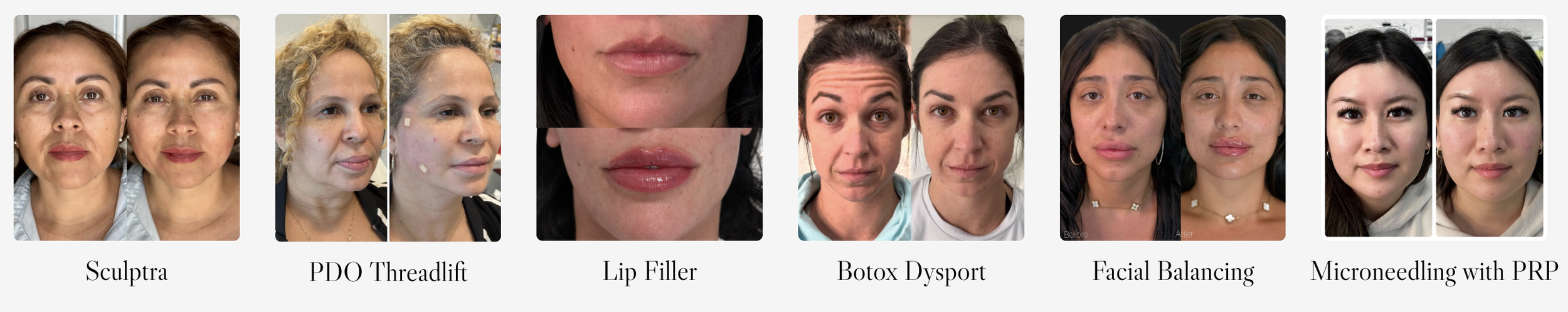 Best Medspa in Long Beach, CA, 90808
