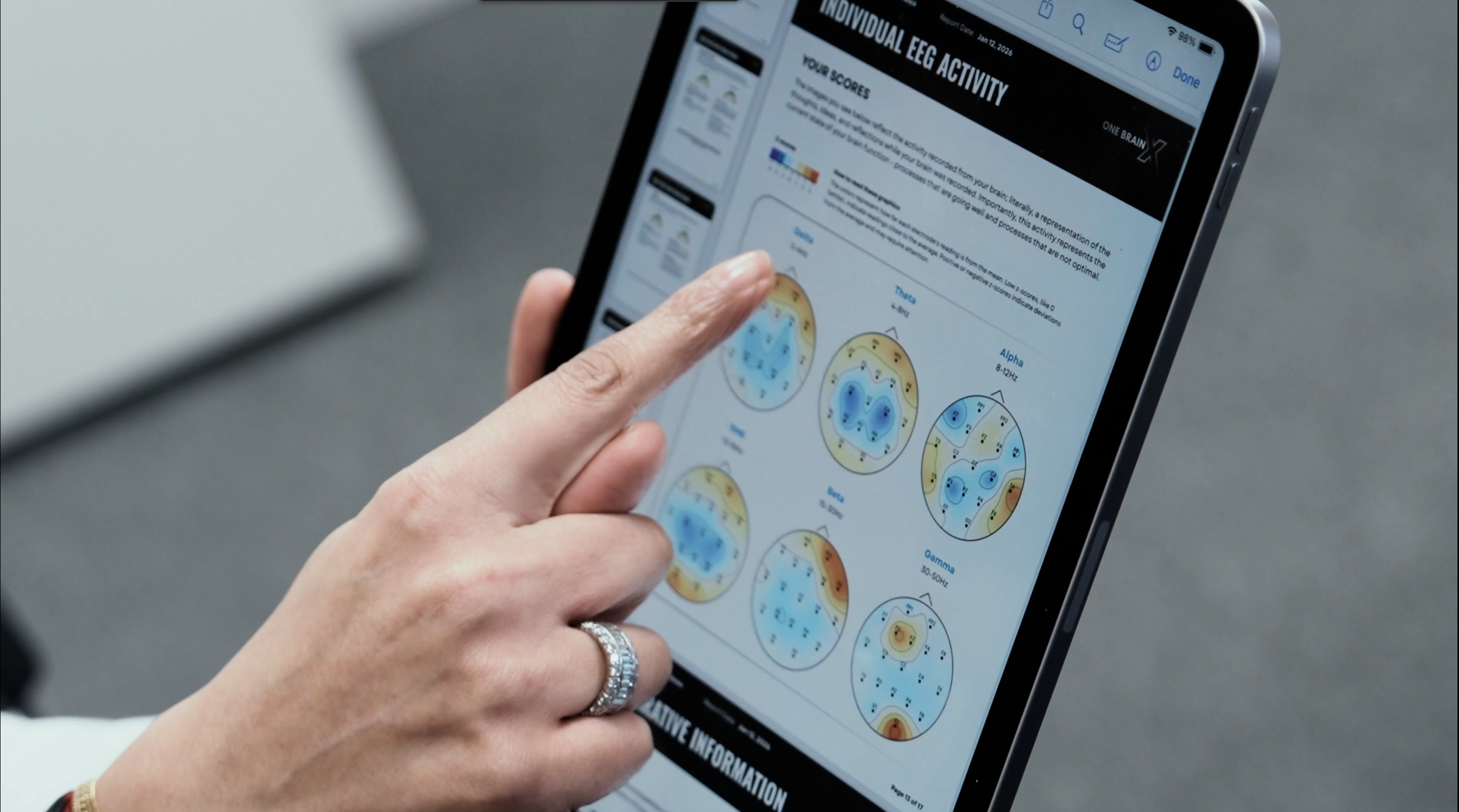 Neurofeedback training