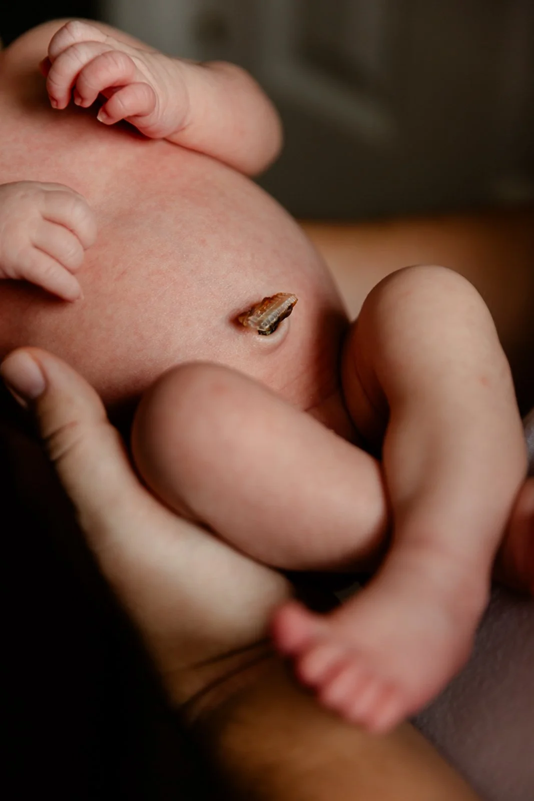 Close-up of a newborn baby being held, with an umbilical cord stump visible on the baby's abdomen.