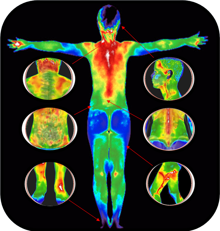 Thermography Scans